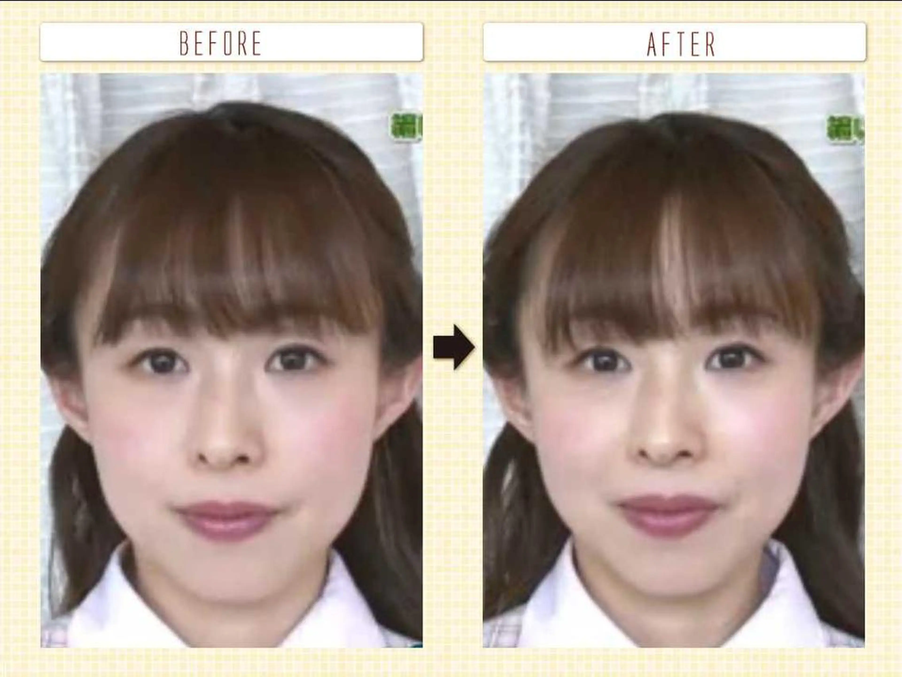 むくみたるみ専門☆ 美容鍼・小顔矯正のエステ・リラクイメージ