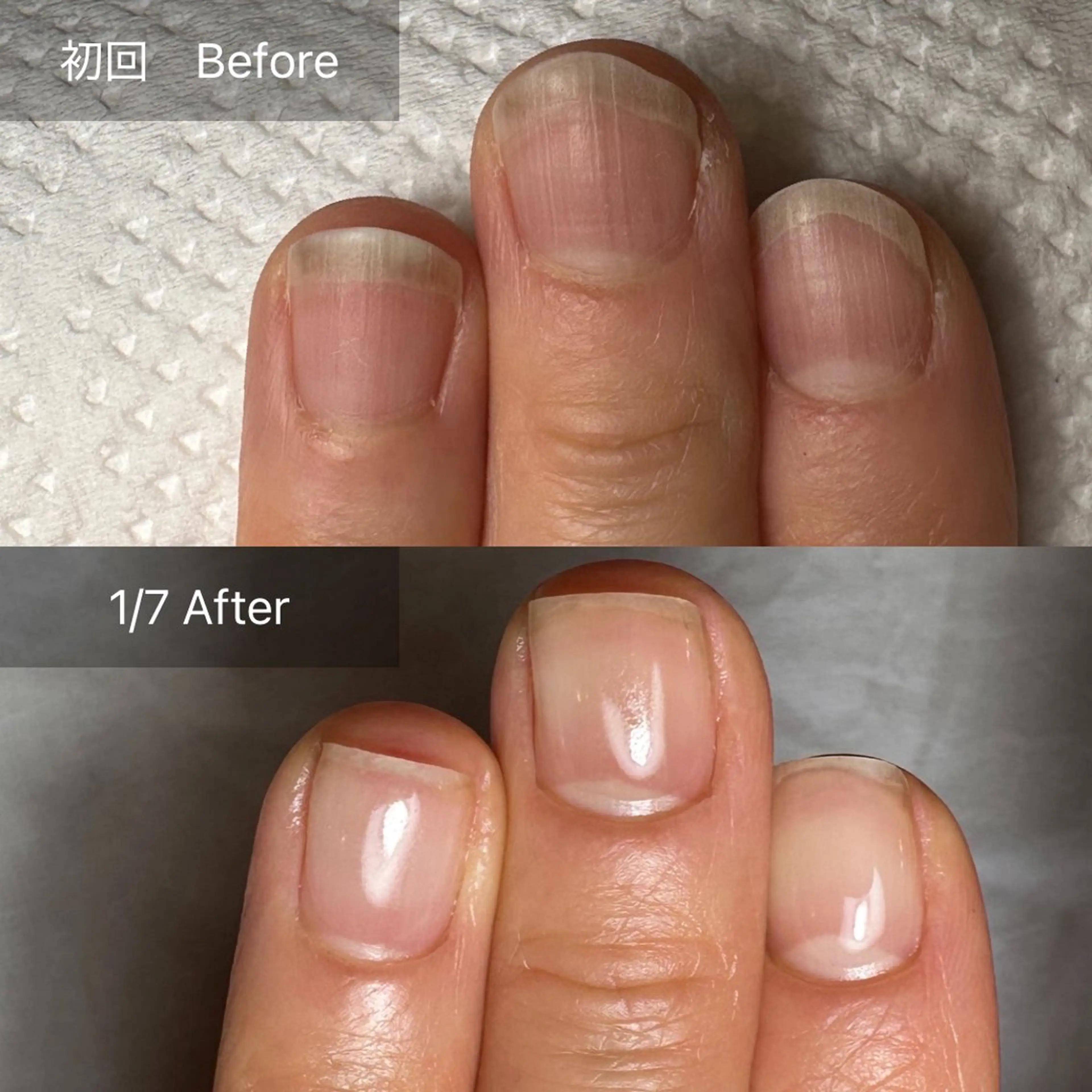 ＼モニター様限定／自爪ジェル育成💅の写真