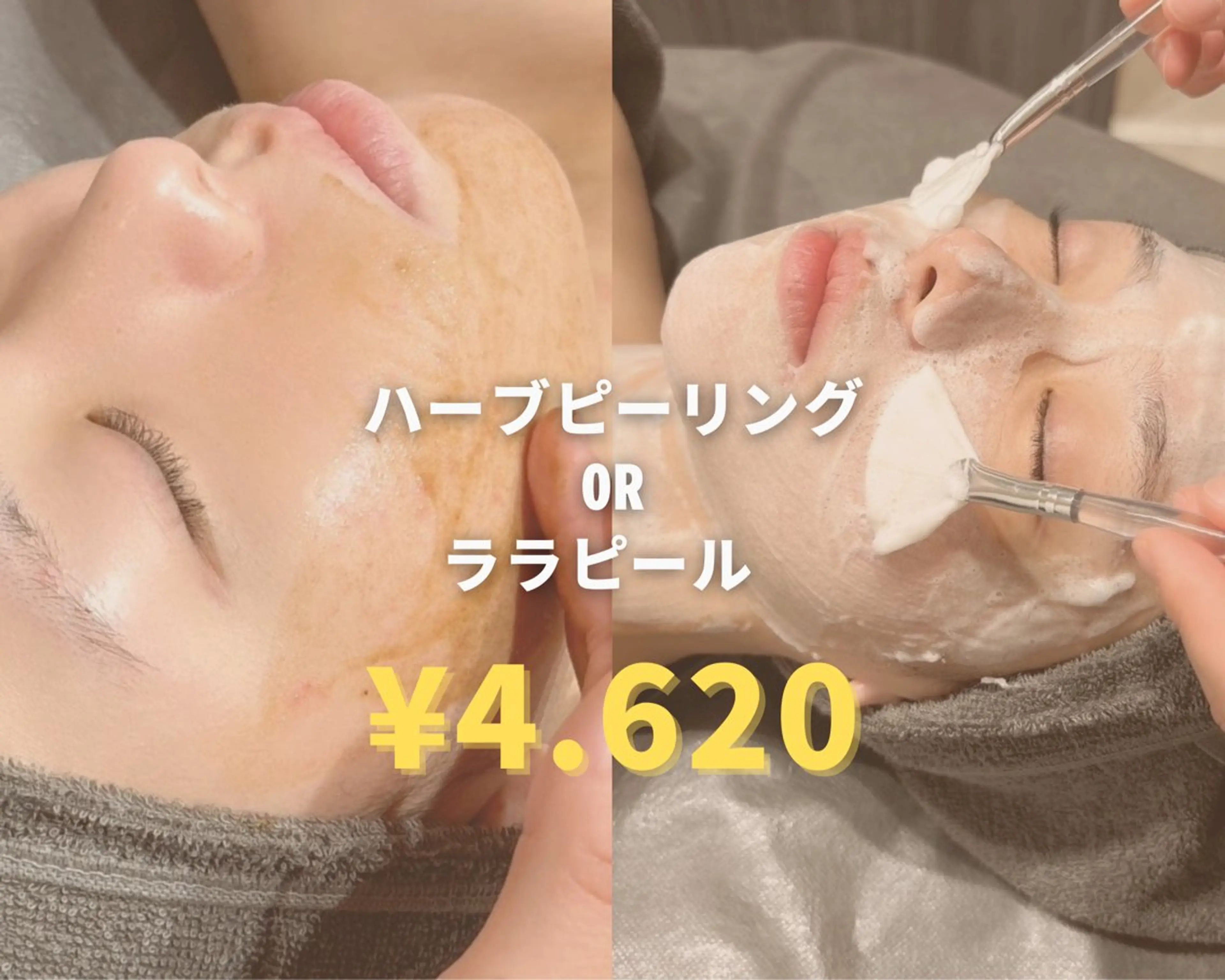 【新規様限定】⭐︎ララピール・ハーブピーリング⭐︎各種¥7.700→¥4.620の写真