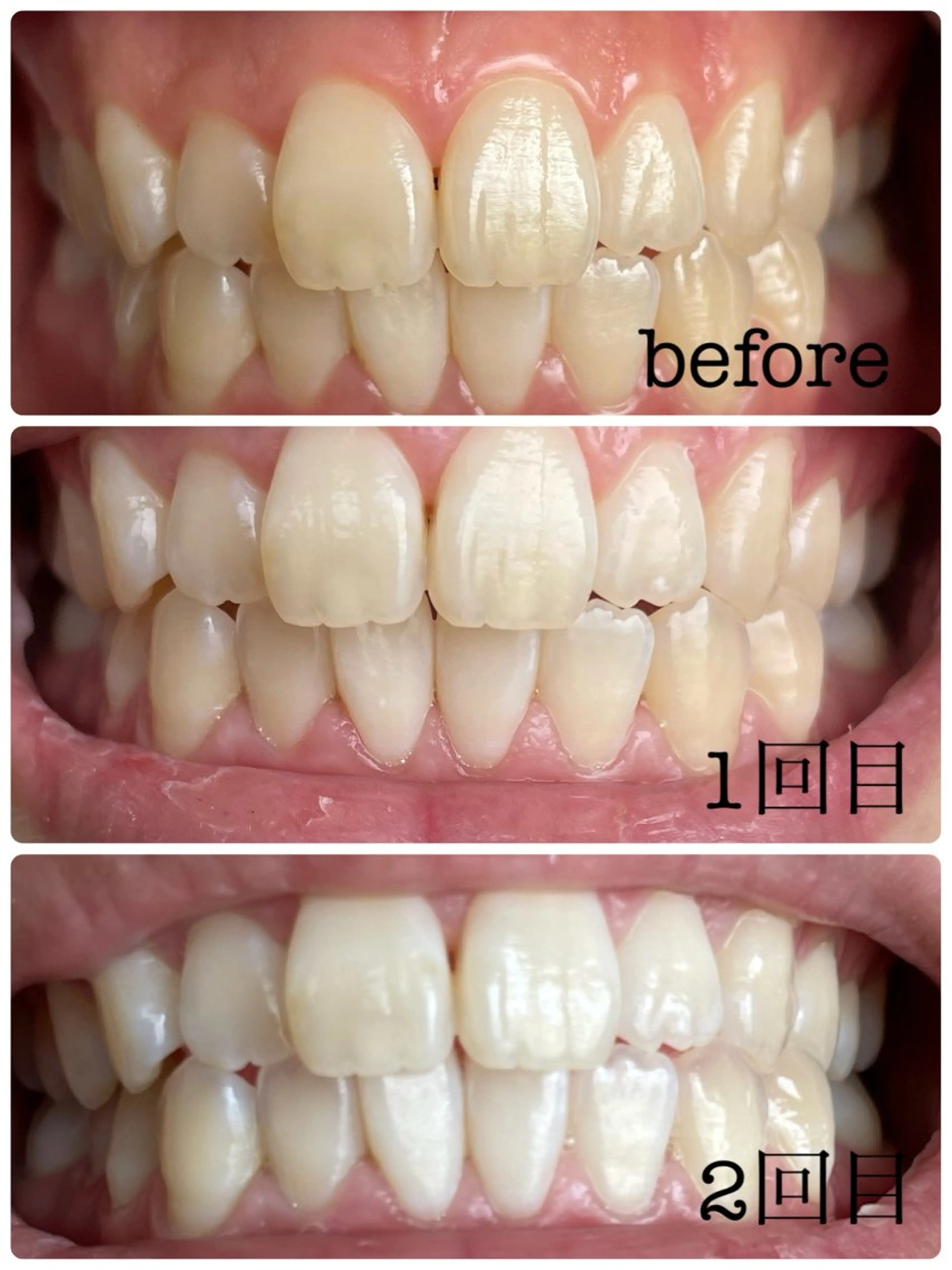 その他 whitening salon Y&U所属・ホワイトニングサロン Y&Uのその他イメージ