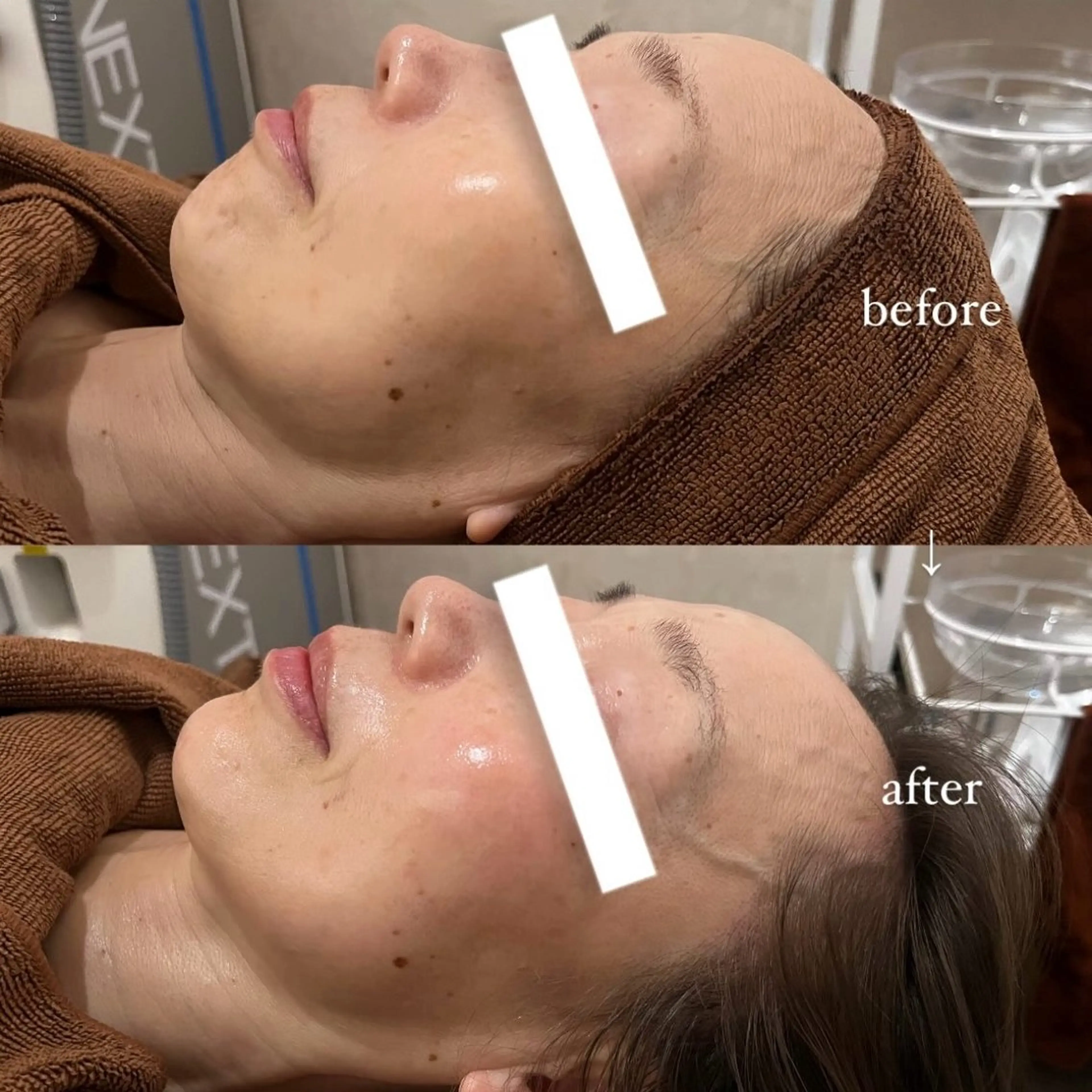 NOEL所属・フェイシャルエステ Utaiのエステ・リラクイメージ