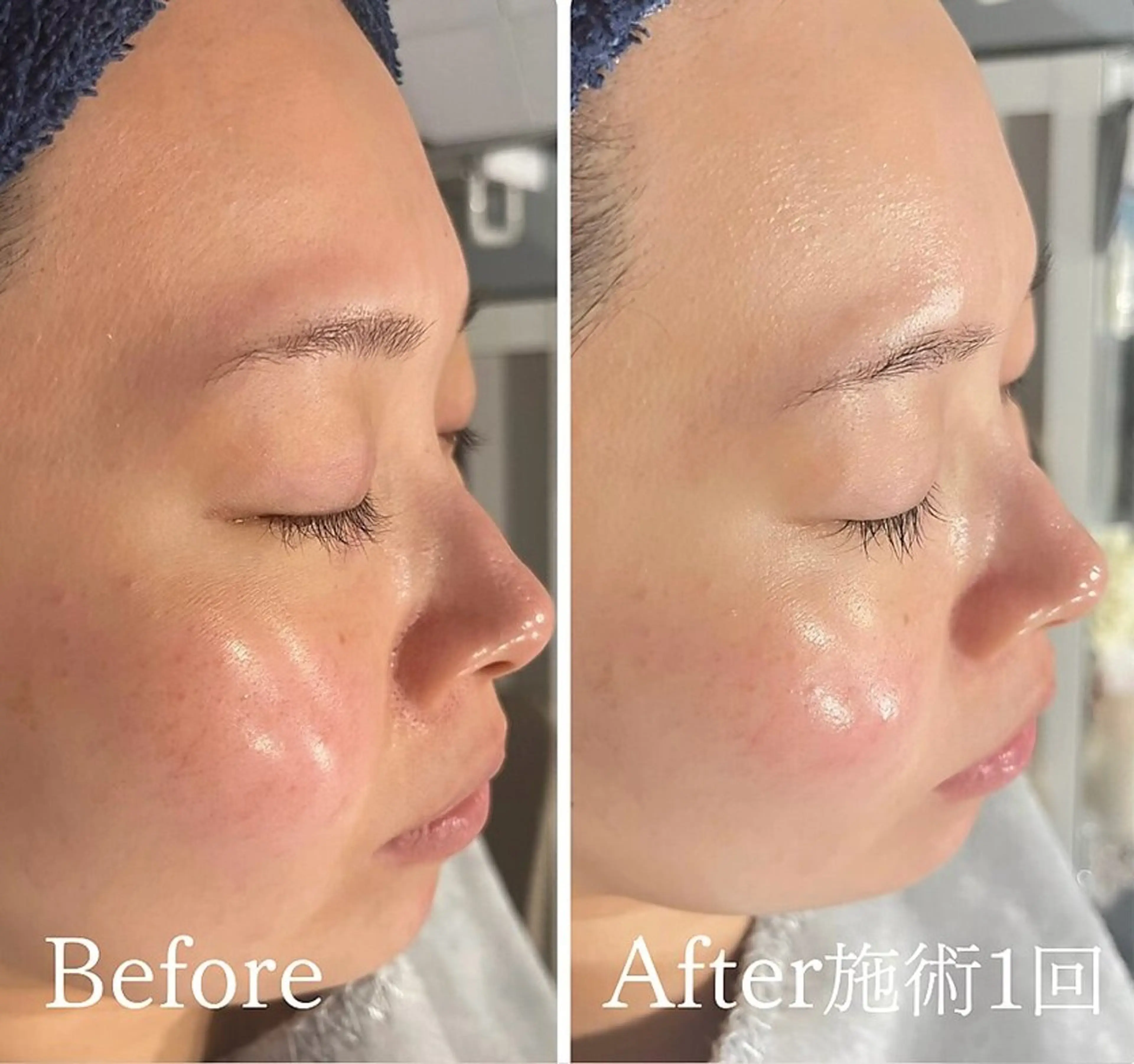 アンド ミルルのエステ・リラクイメージ