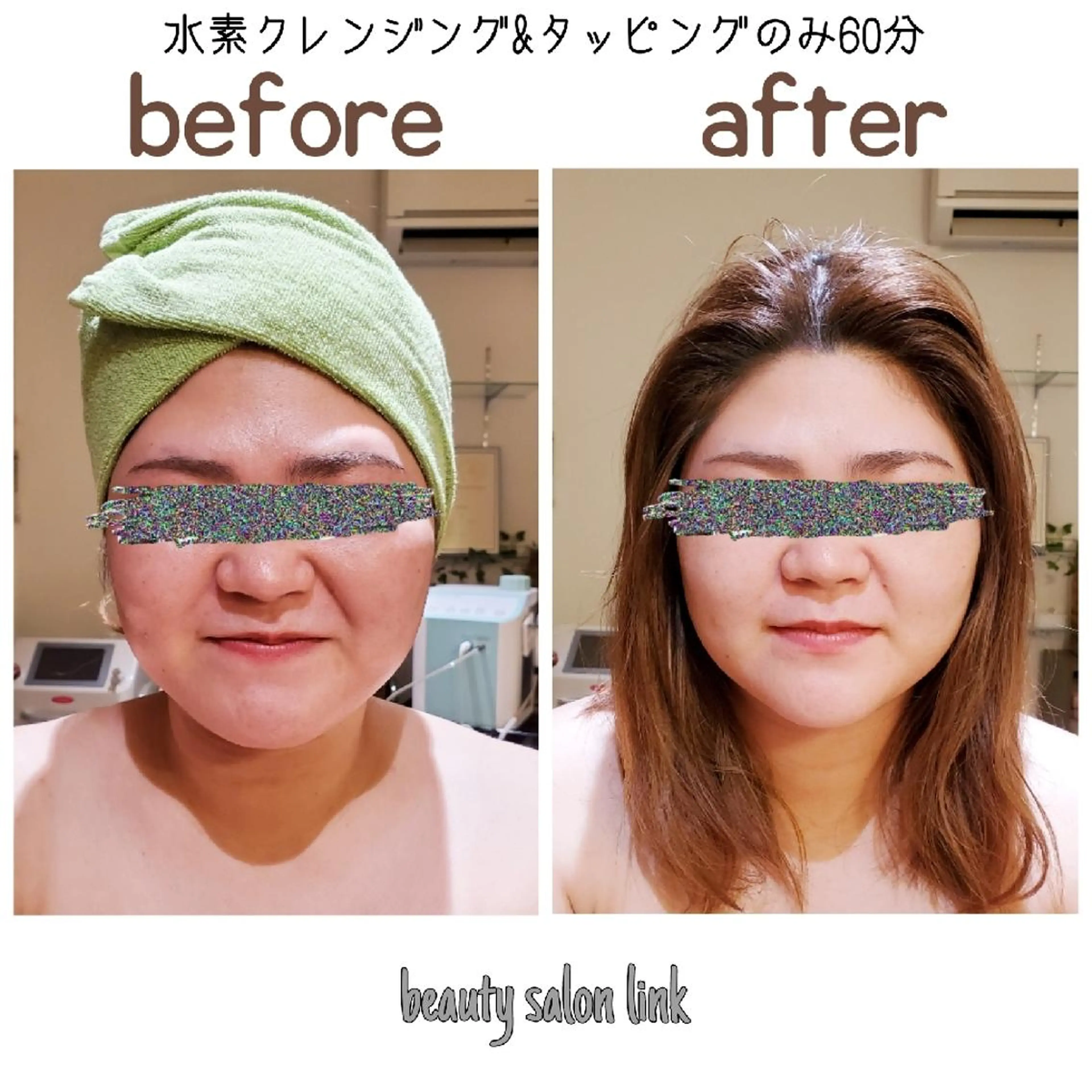 ミニモ限定メニュー🙆ツヤツヤもっちりになる水素美顔フェイシャル✨80分 身体すっきりデコルテマッサージ付き💫の写真