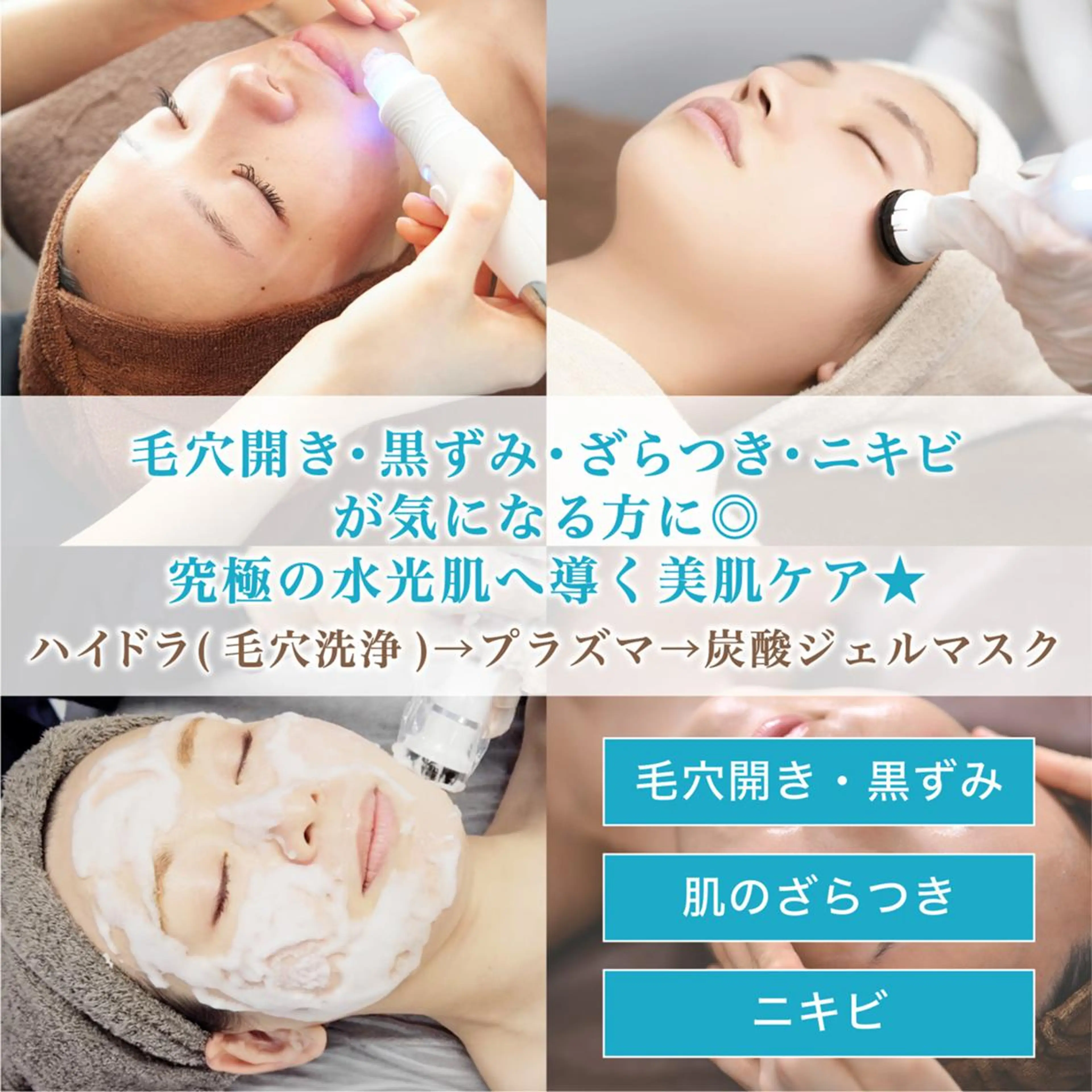 【毛穴開き、毛穴詰まり解消】プラズマとハイドラセットで水光肌へ✨炭酸パック＆ヒアルロン酸導入🩵の写真