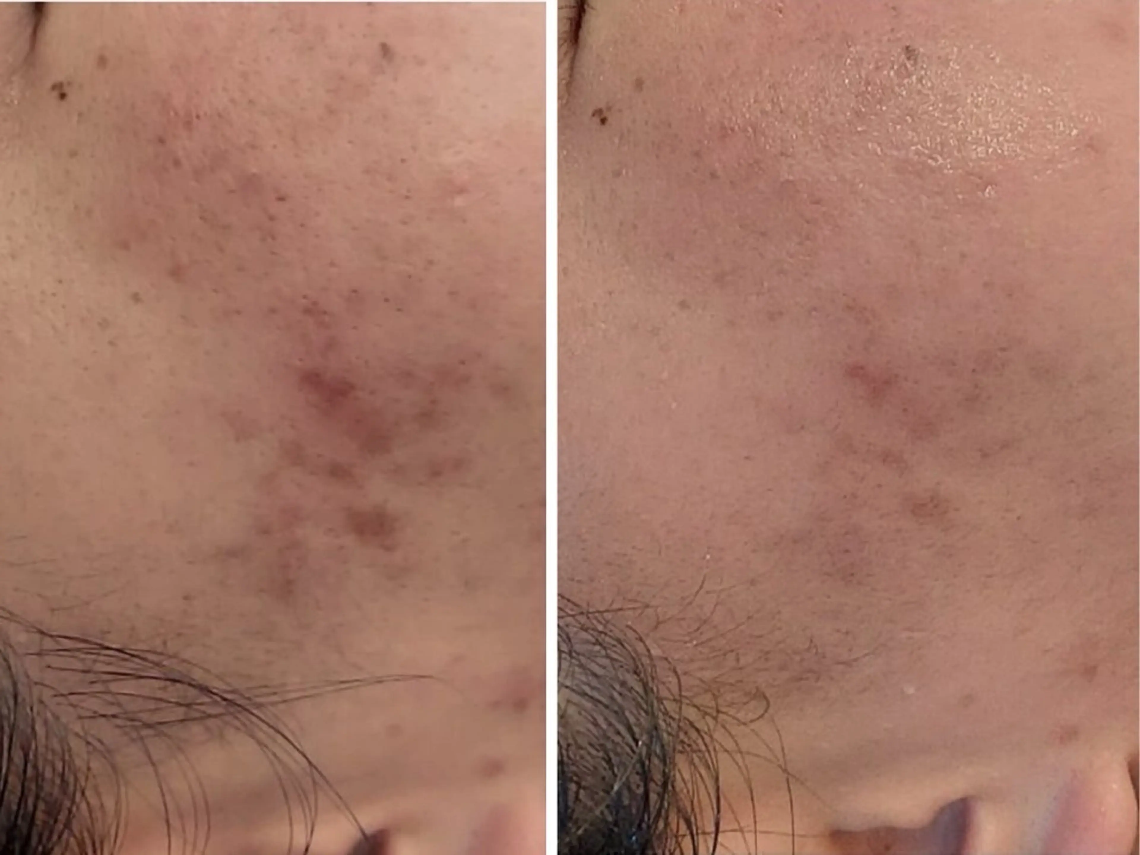 エステ シミケア専門サロンLICCO’S所属・シミケア専門サロン LICCO’S岡崎のエステ・リラクイメージ