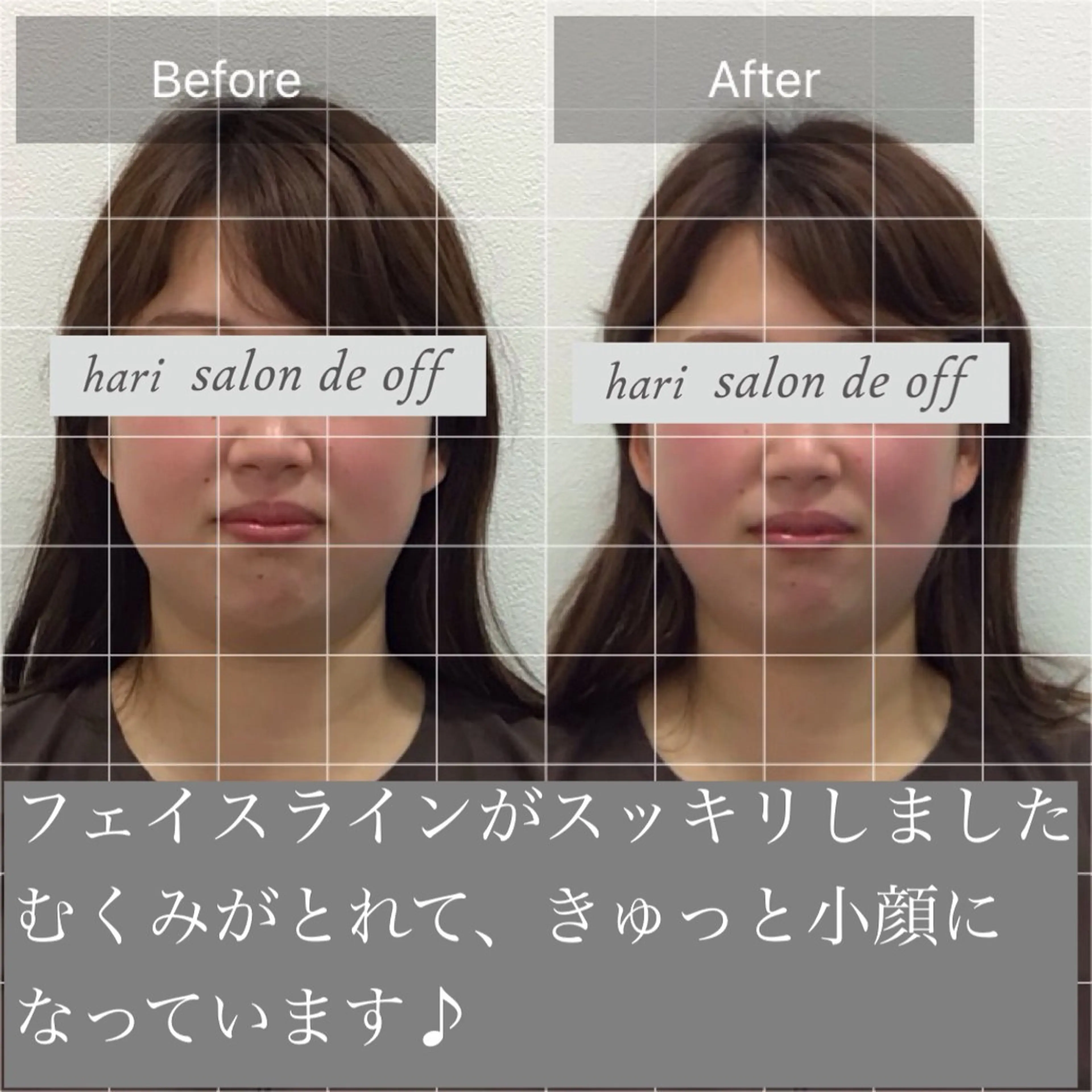 エステ リラク 整体×美容鍼灸 鍼灸師Miyanoのエステ・リラクイメージ