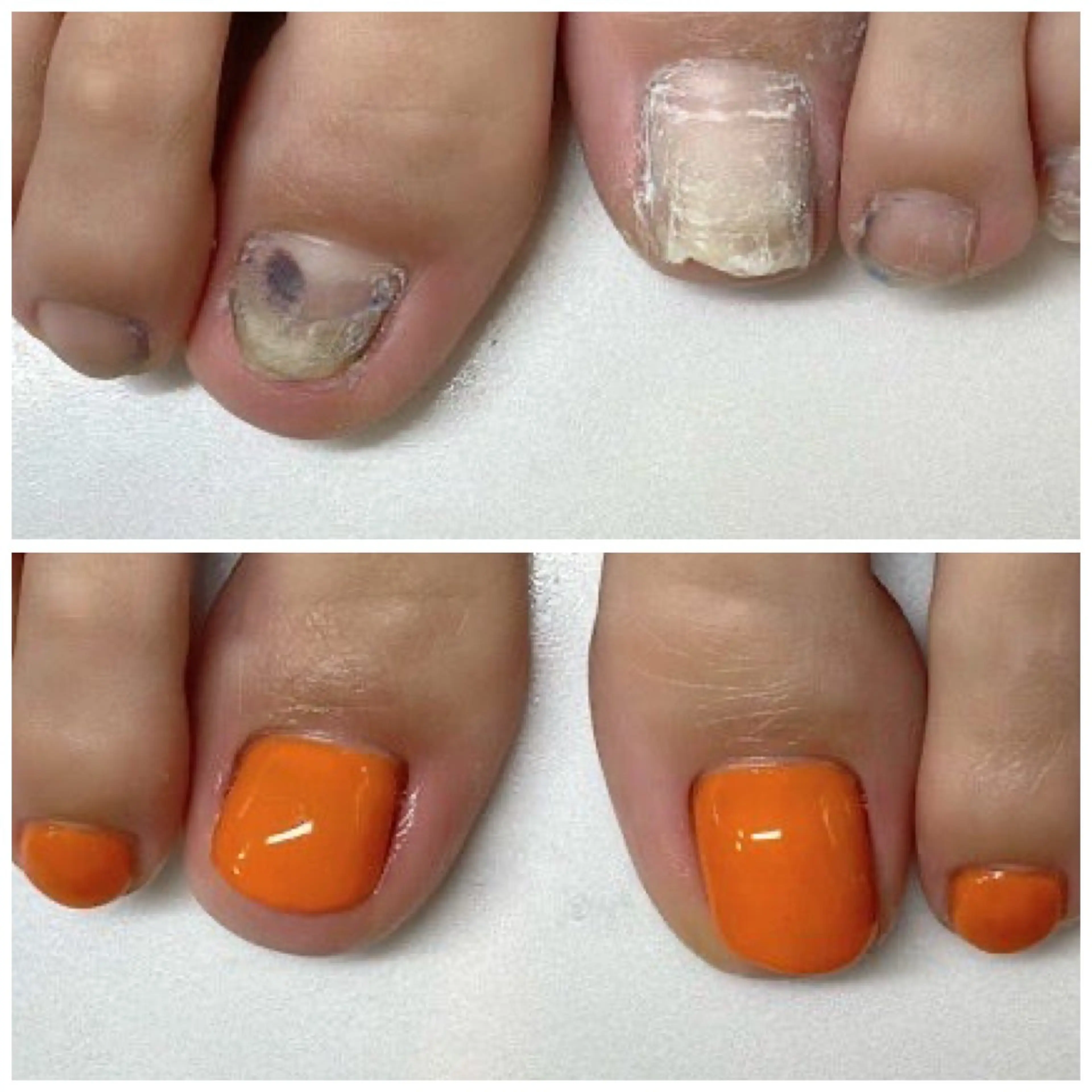 ネイル フットネイル ネイルサロンアリューム所属・ネイルサロン アリュームのネイルデザイン