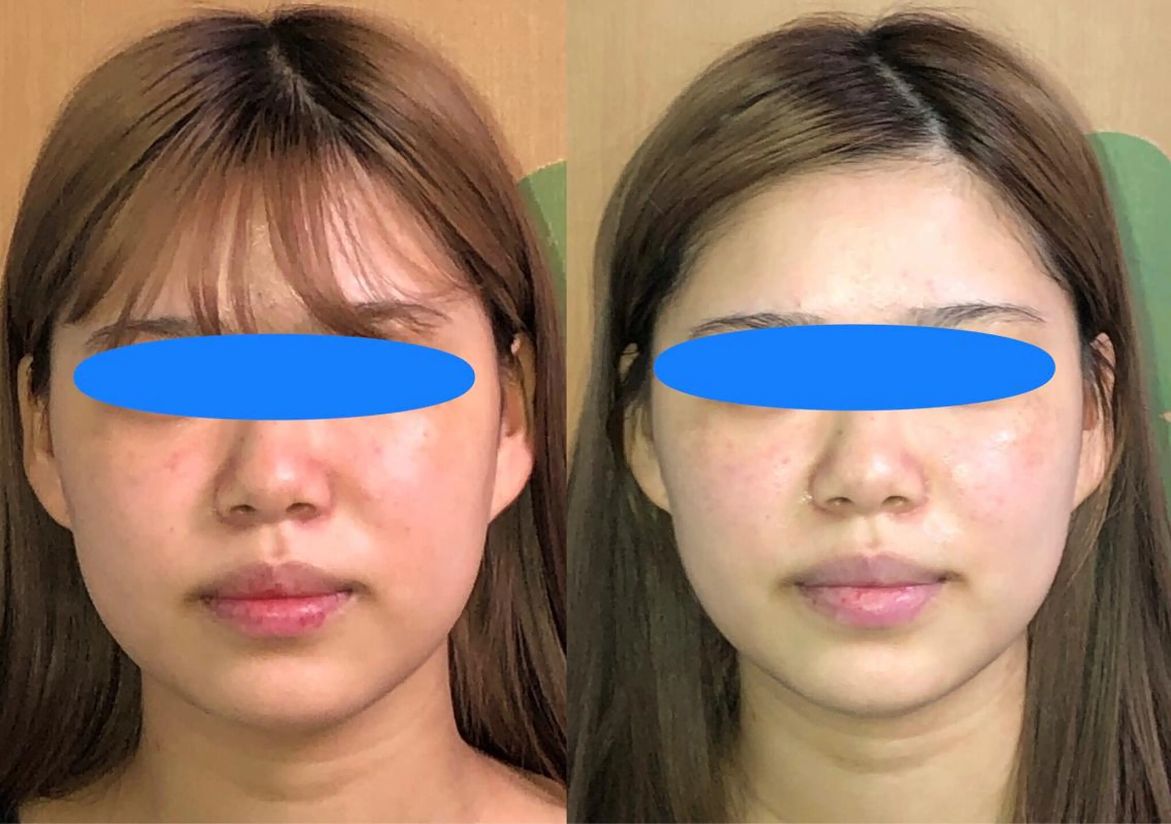 エステ リラク 春日井トータルからだ サロンふくふくのエステ・リラクイメージ