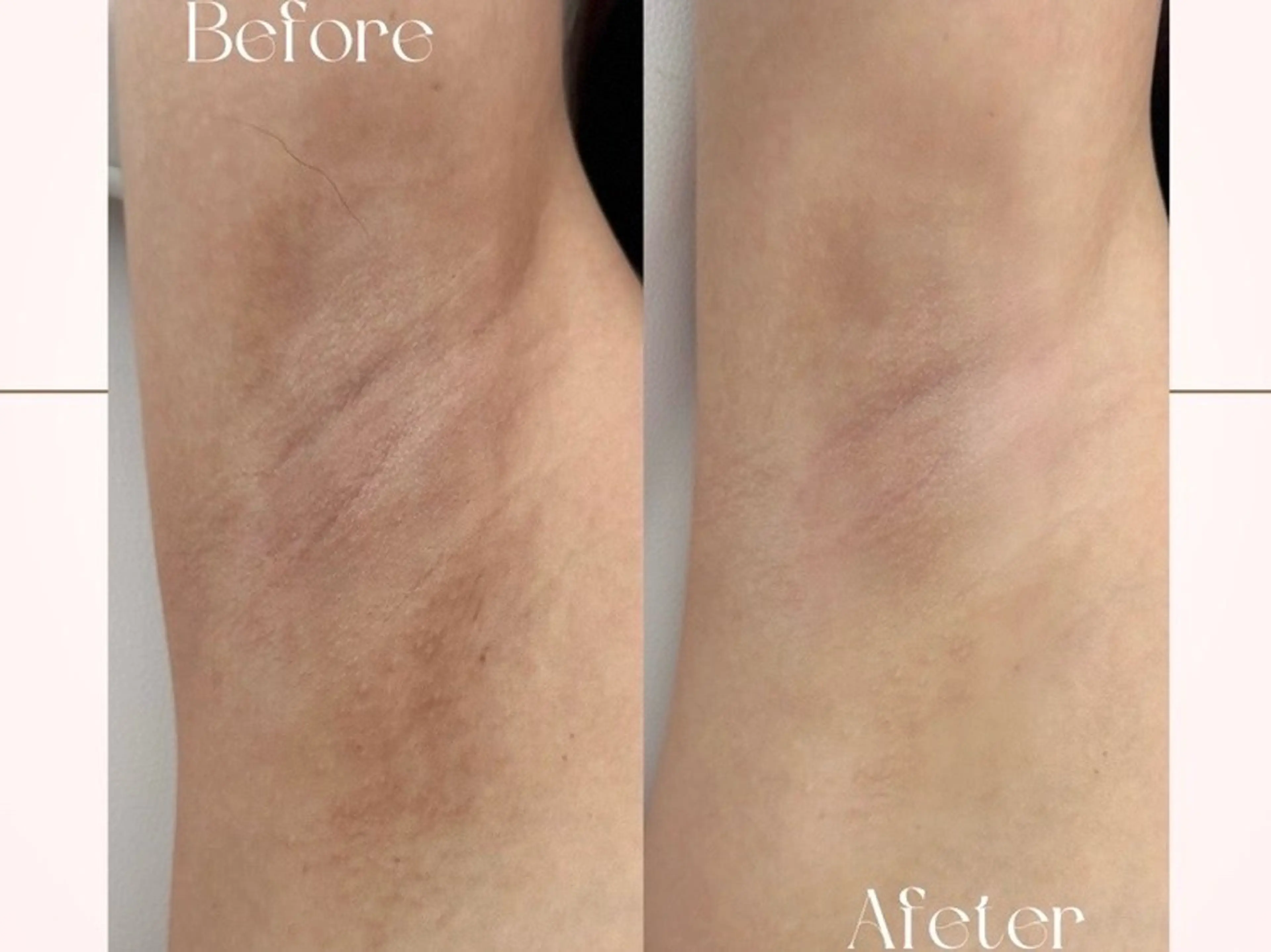 小顔専門看護師クリニカルサロンCOCO所属・小顔と美肌サロン クリニカルサロンココのエステ・リラクイメージ