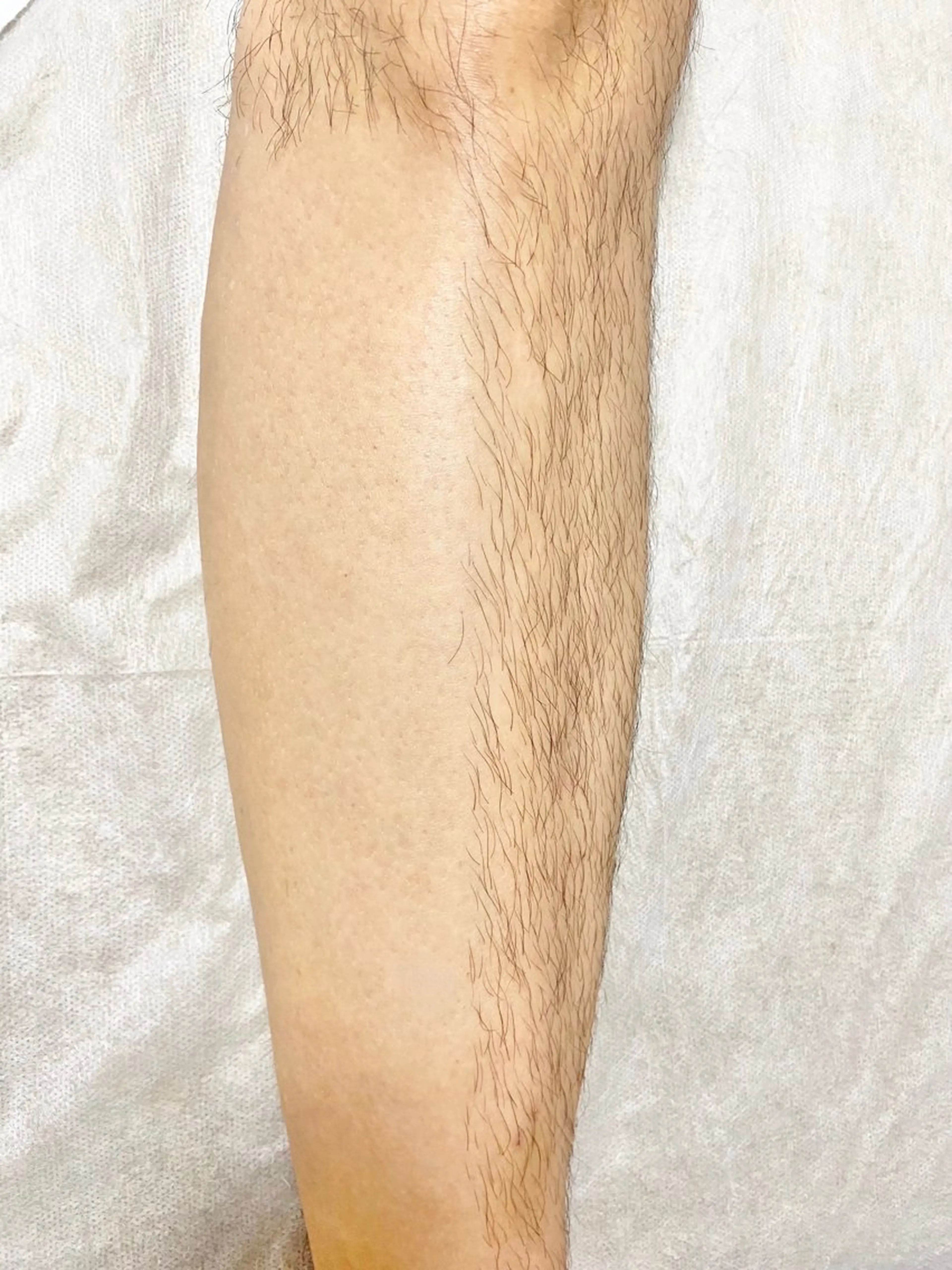 脱毛 &me ayakaのエステ・リラクイメージ