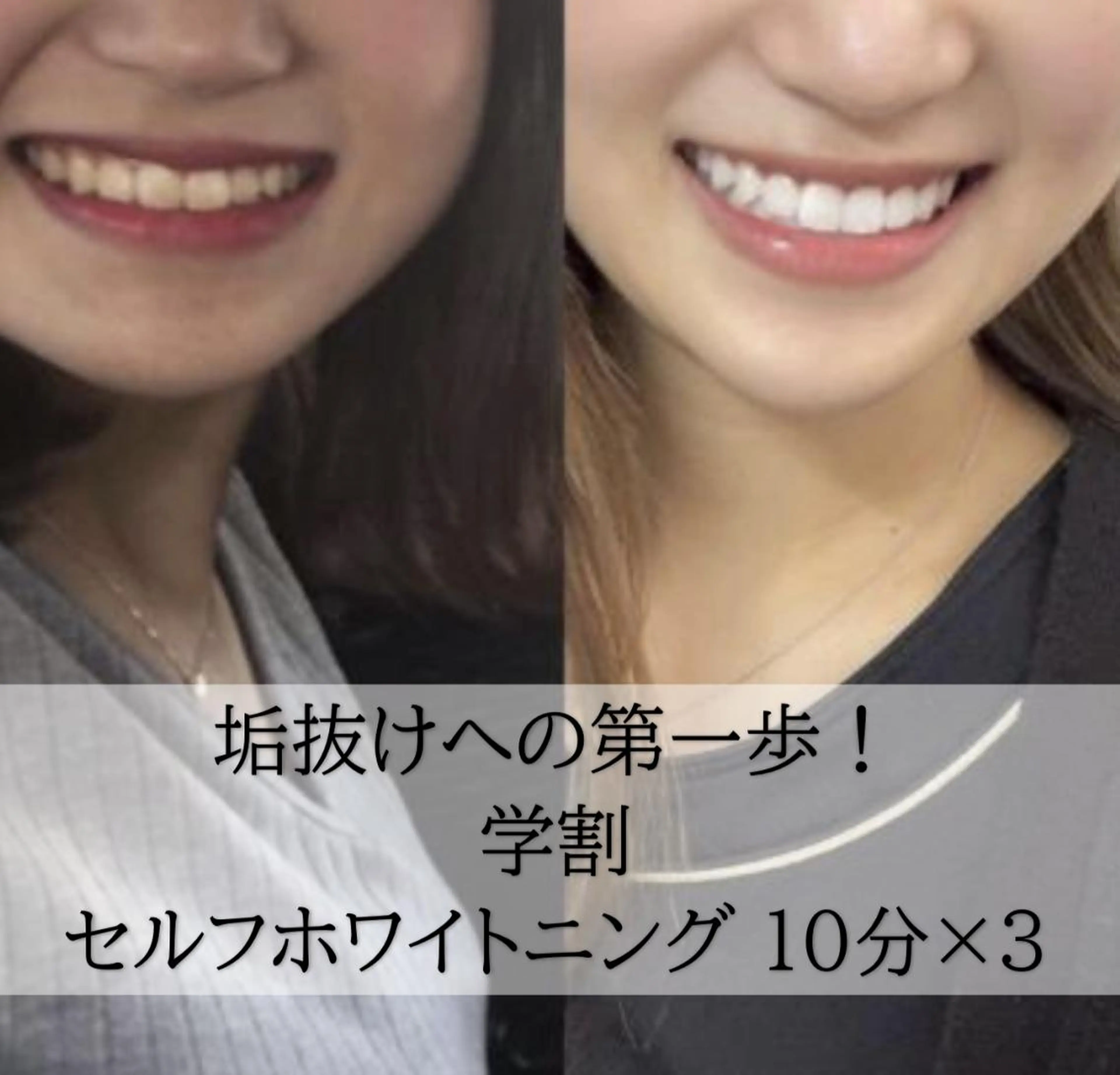 その他 ホワイトニング専門店 LCS 銀座店 峰岡のその他イメージ