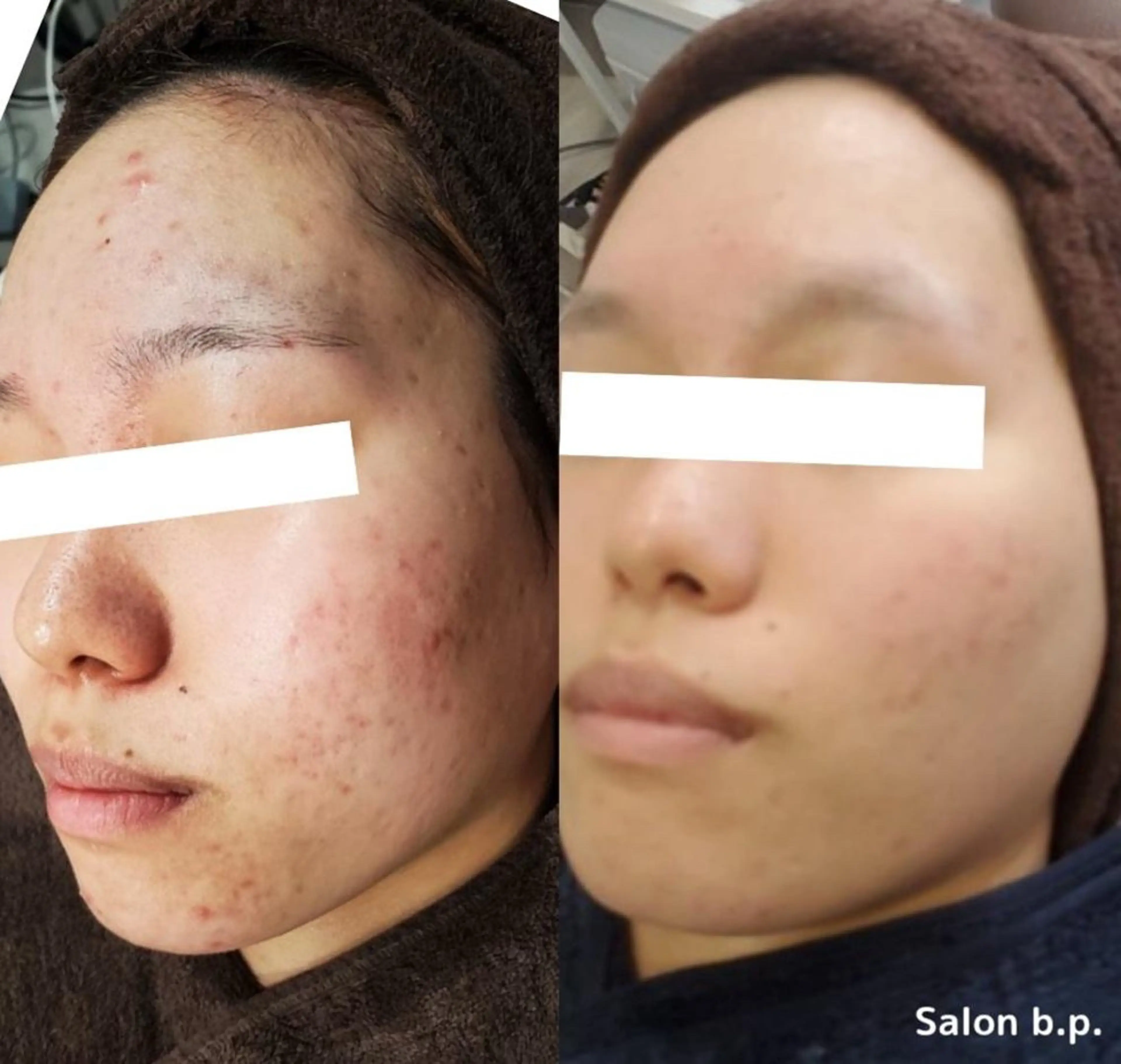 Salon b.p. 渋谷🤍Rinのエステ・リラクイメージ