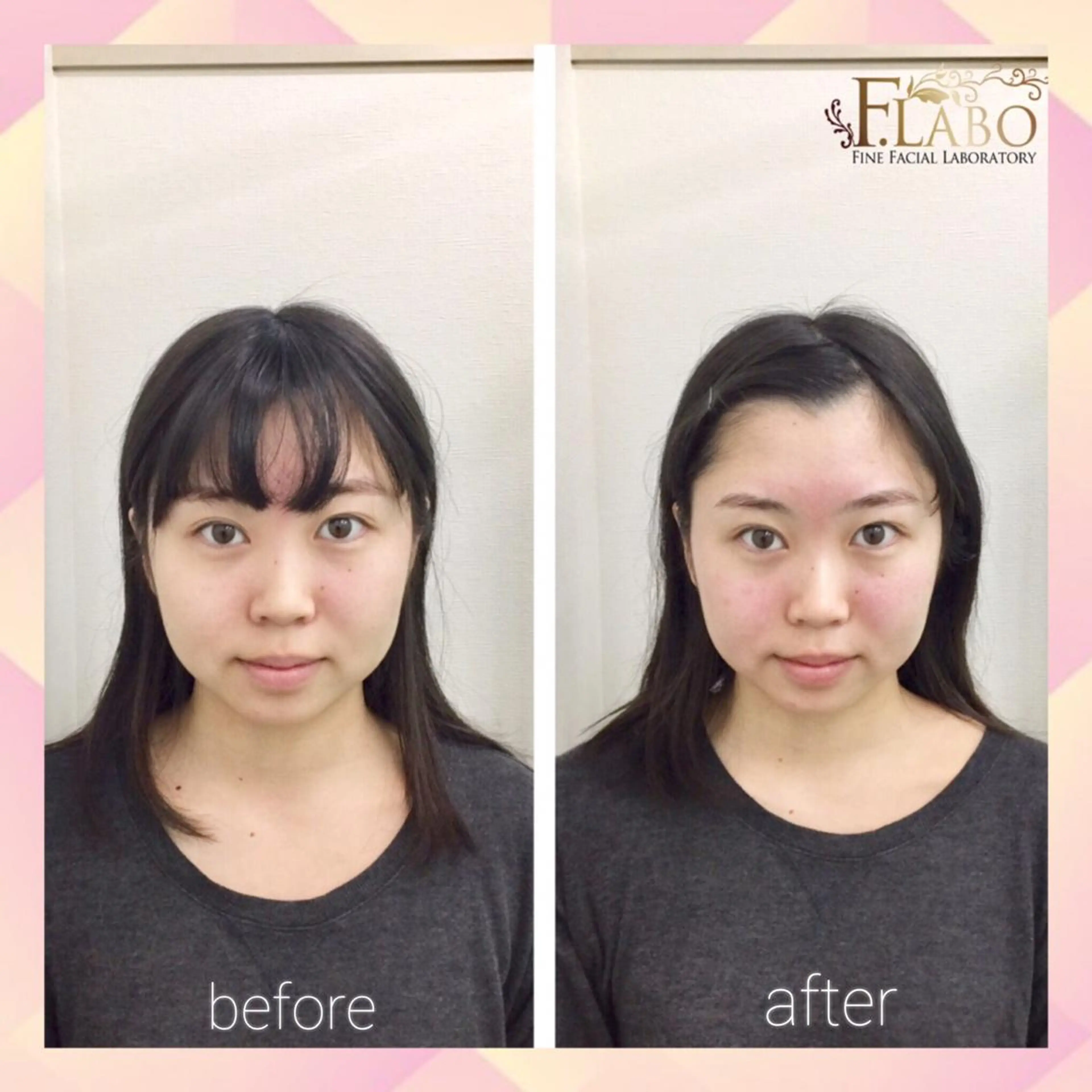 小顔&ダイエットジム エステ担当REIKOのその他イメージ