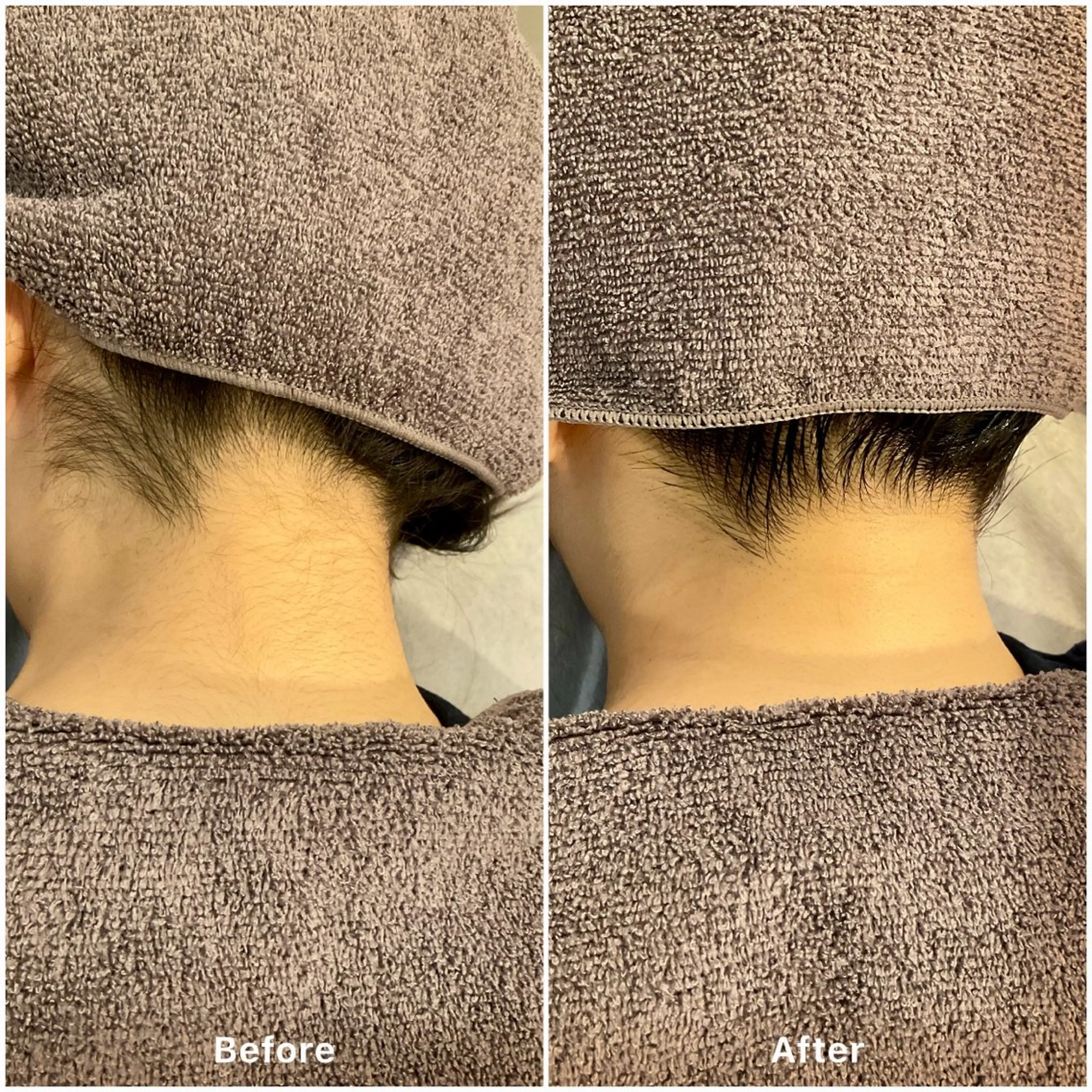 脱毛 ✨韓国肌管理✨ Lisaのエステ・リラクイメージ