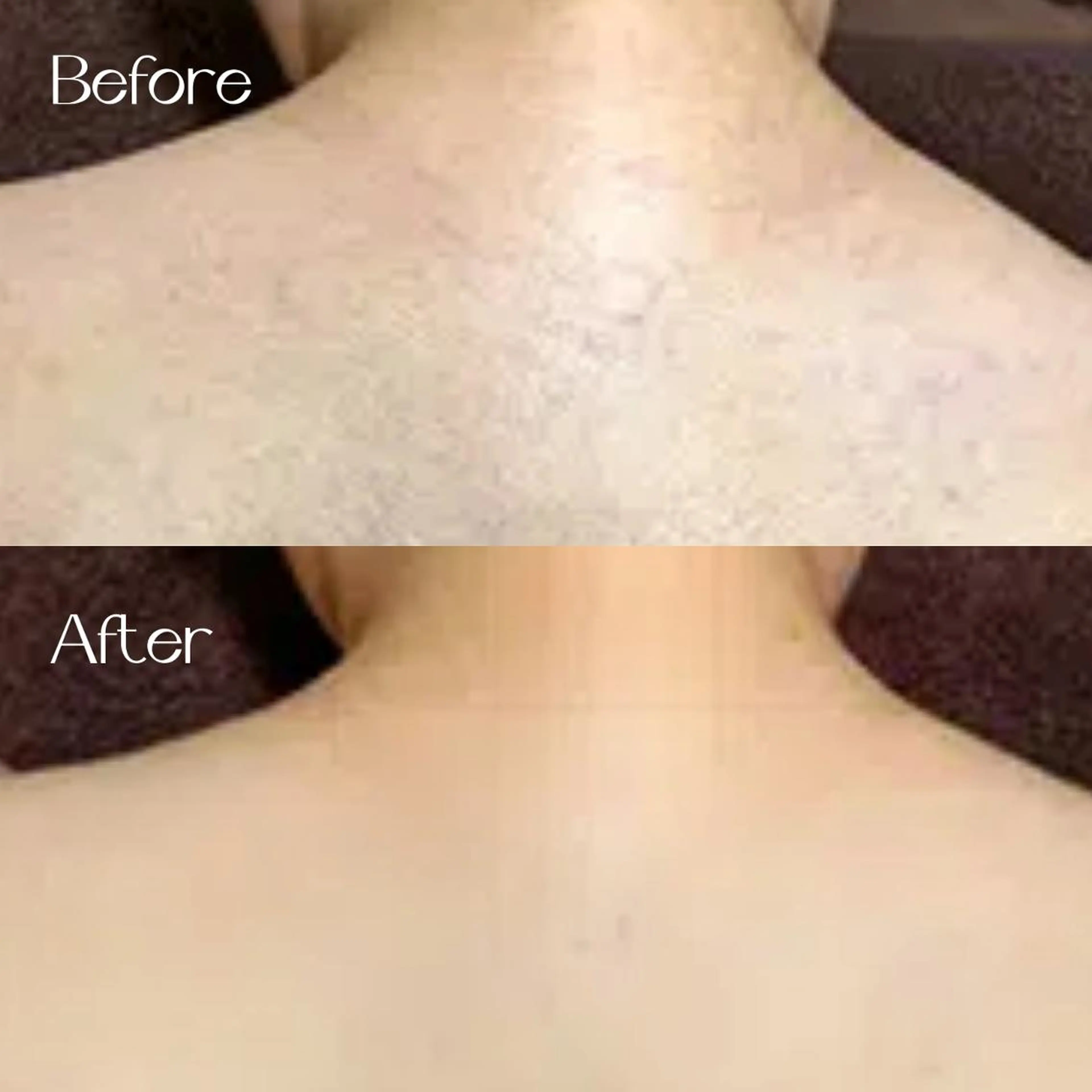 脱毛 MyFairLady miuのエステ・リラクイメージ