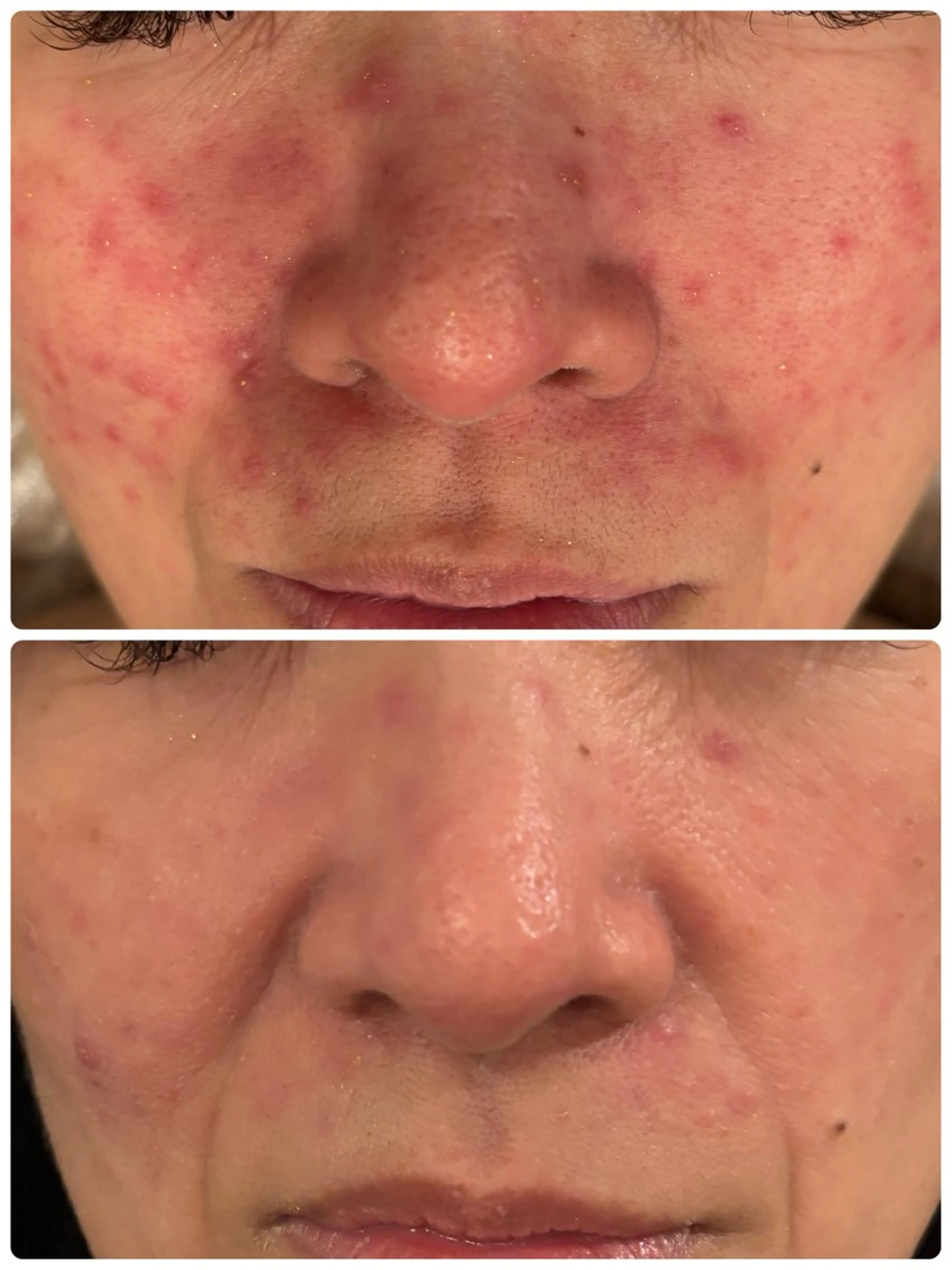 Mind care&stretch所属・Mizyu ハーブピーリングのエステ・リラクイメージ