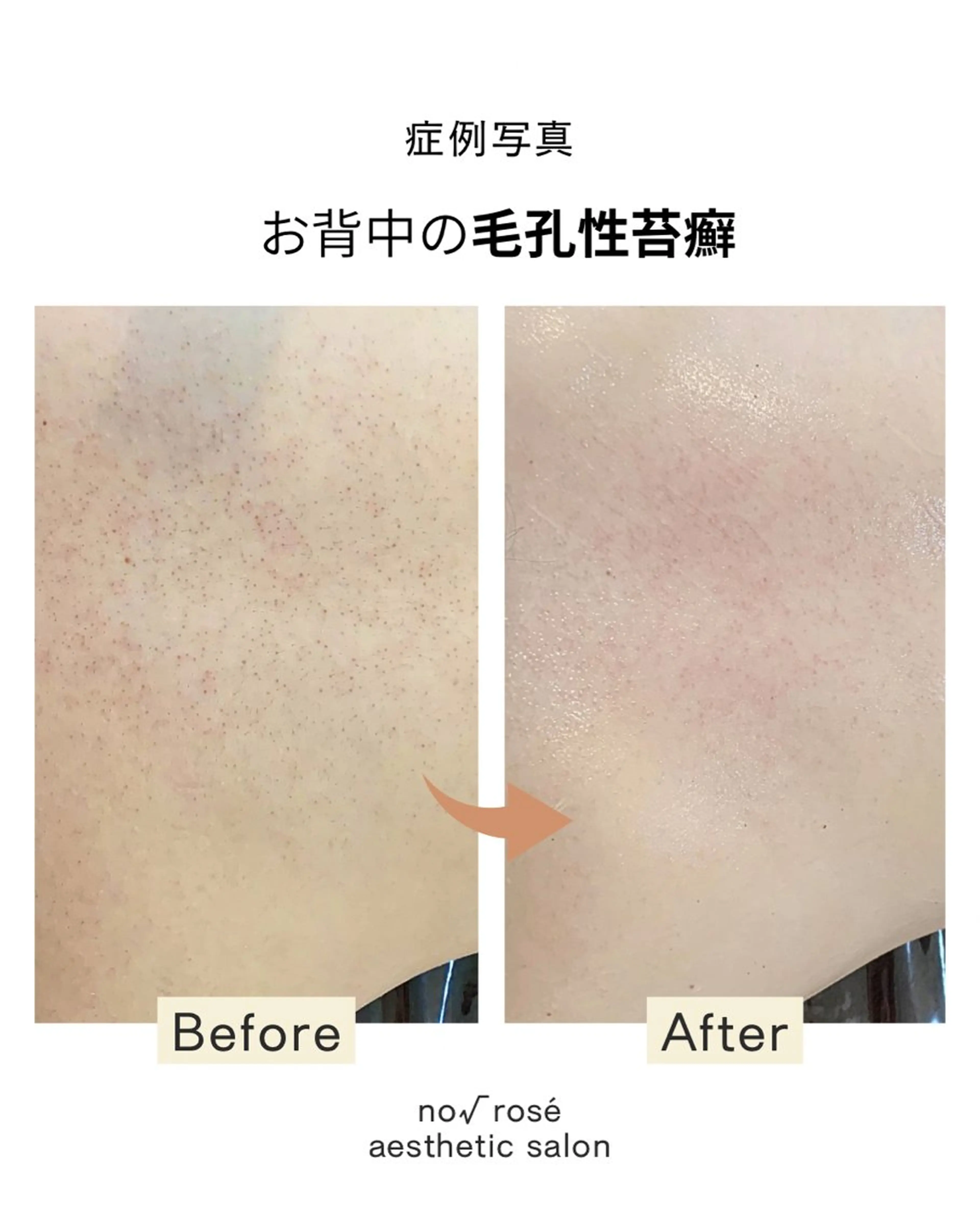 ノールート ロゼのエステ・リラクイメージ