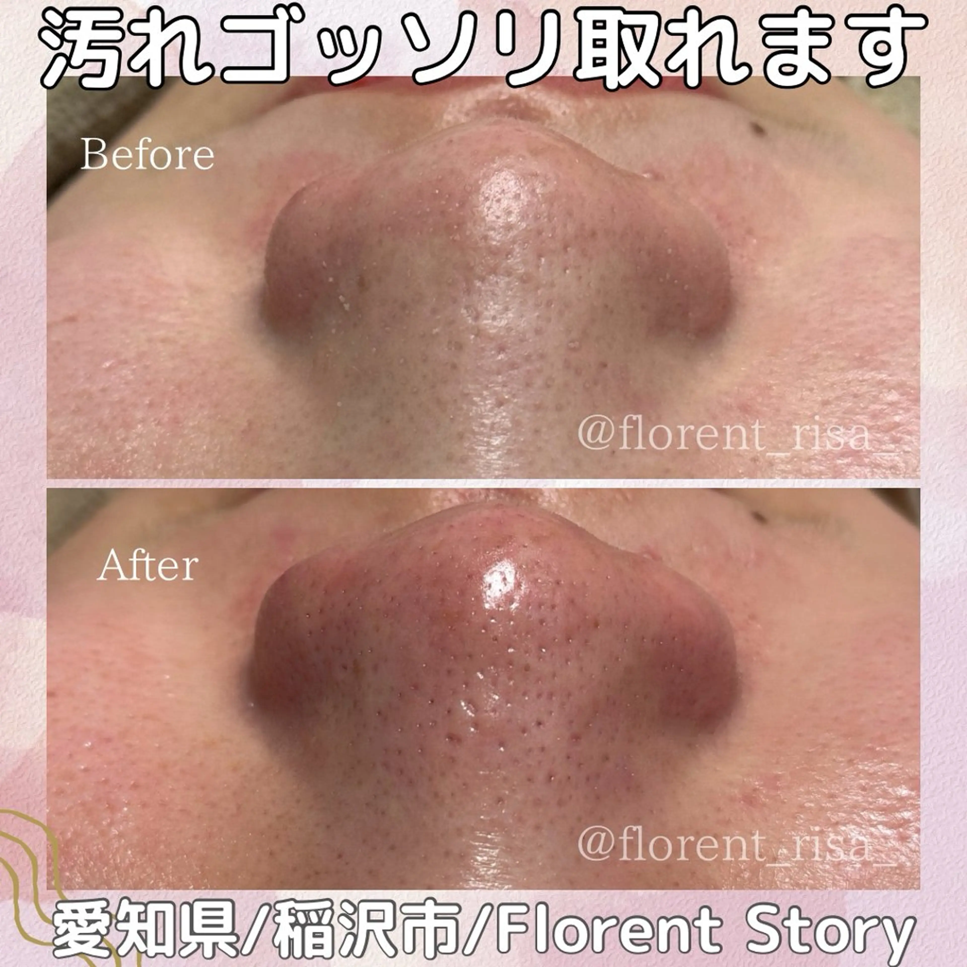 エステ 田中 里沙のエステ・リラクイメージ