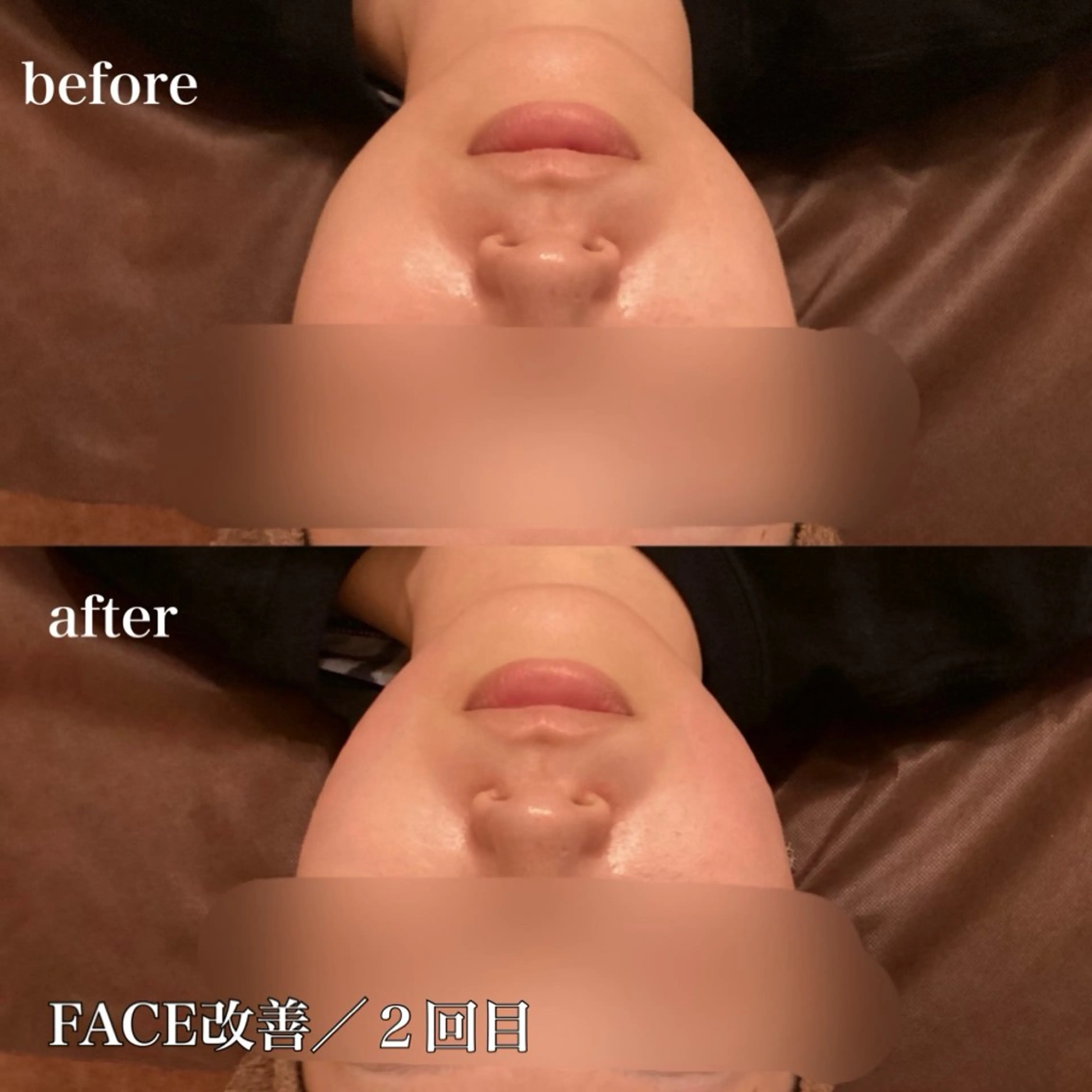 磐田｜LAYLA 一番丁寧な脱毛店のエステ・リラクイメージ