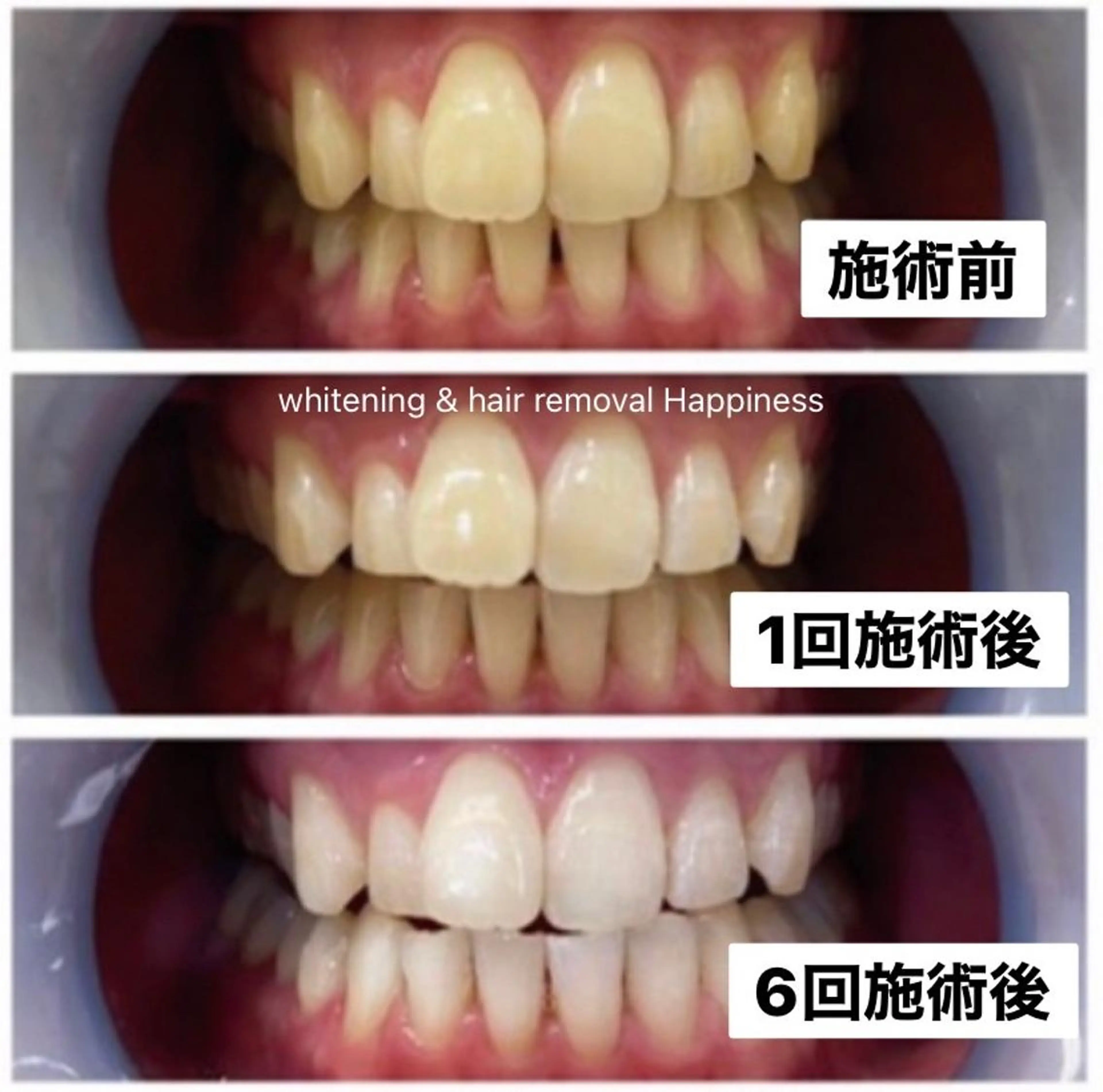 倉本(店長) ハピネス心斎橋本店のエステ・リラクイメージ