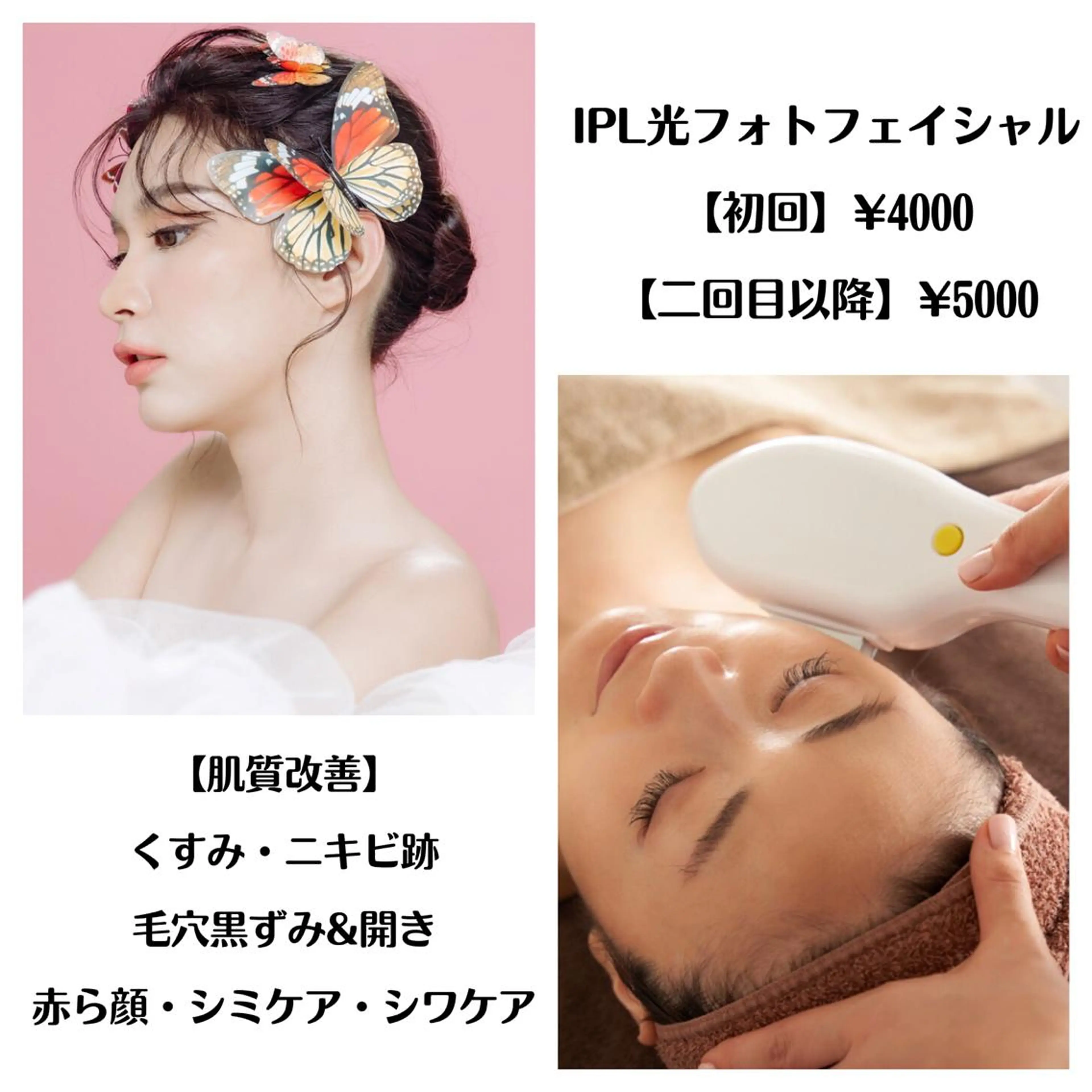 ショート カラー パーマ ヘアアレンジ メンズ キッズ ネイル マツエク・マツパ アイブロウ Chloe-クロエ- 脱毛/フェイシャルのエステ・リラクイメージ