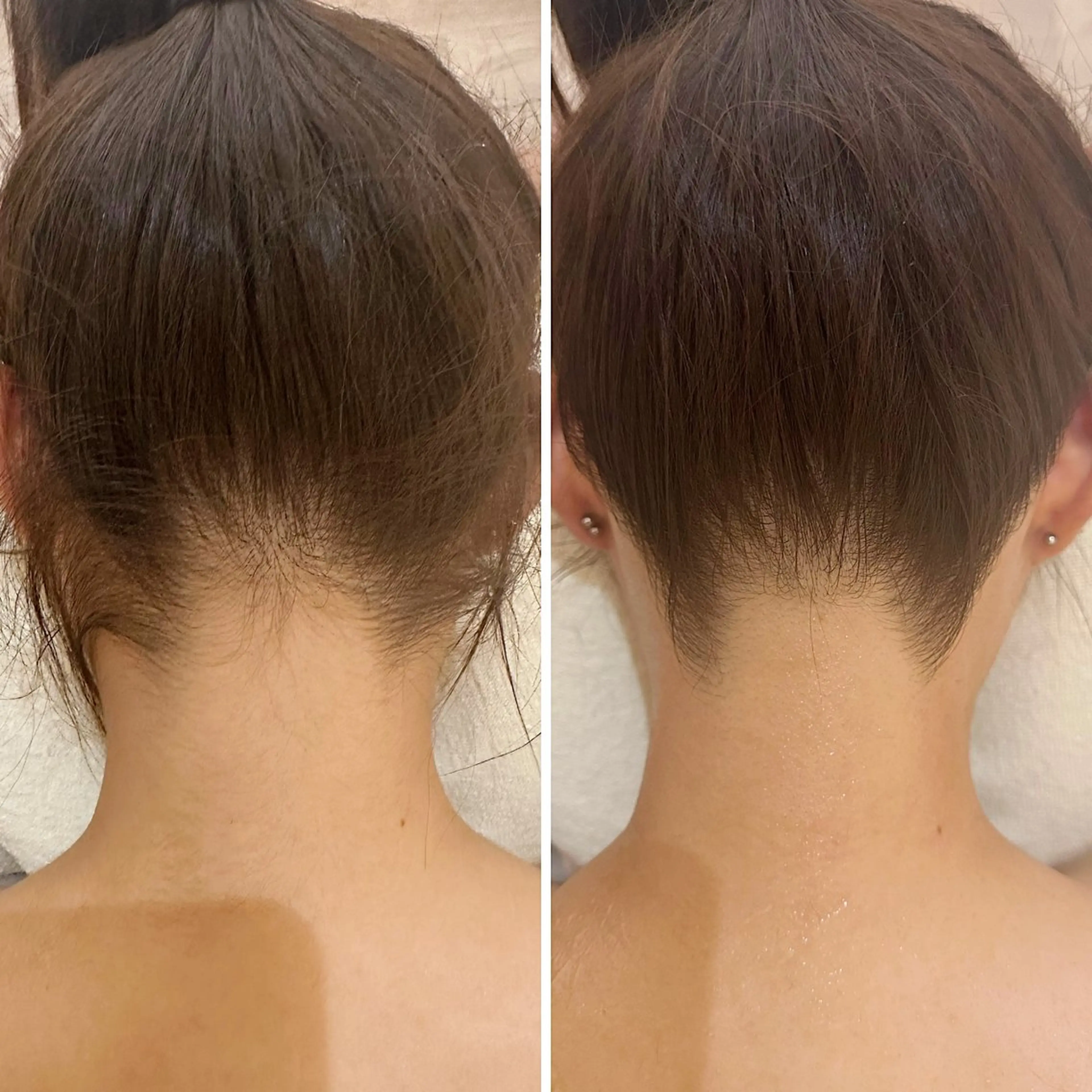 脱毛 うなじ脱毛/美肌脱毛 LABELのエステ・リラクイメージ