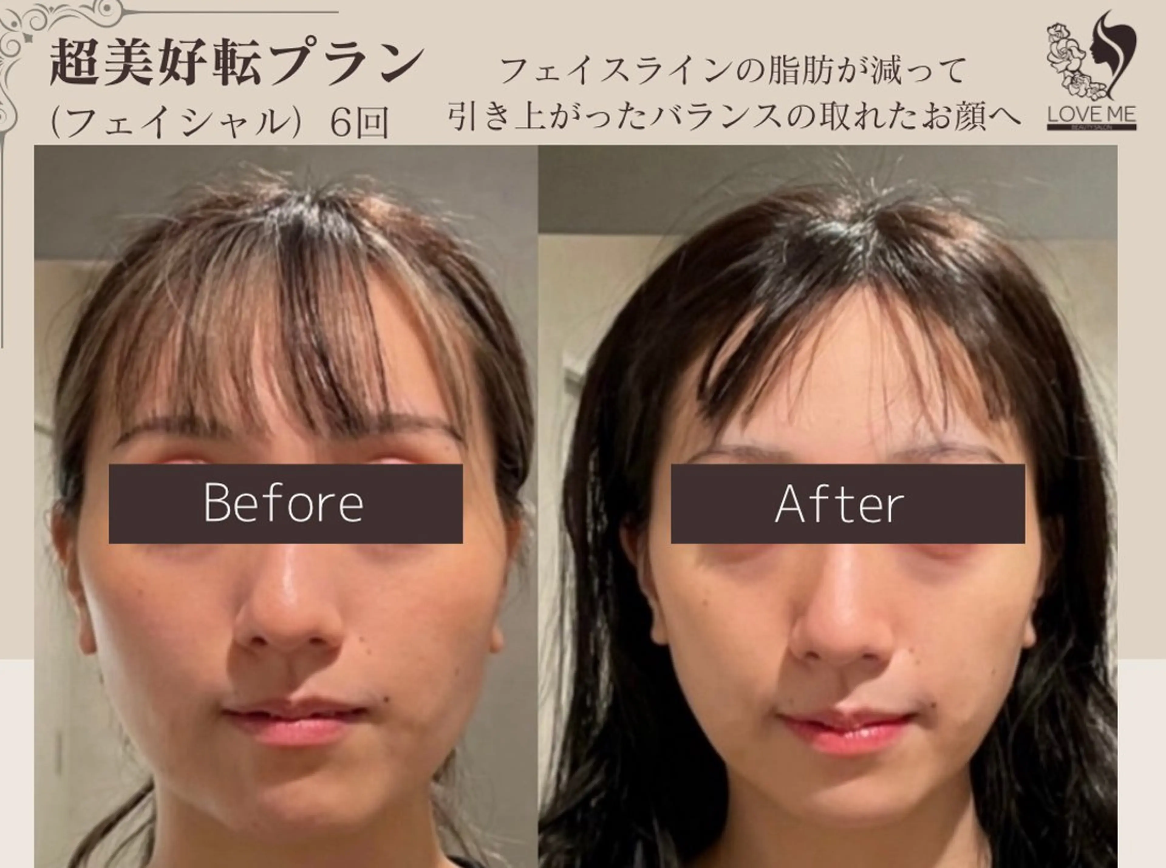 エステ 総合美容サロン LOVEME渋谷本店のエステ・リラクイメージ