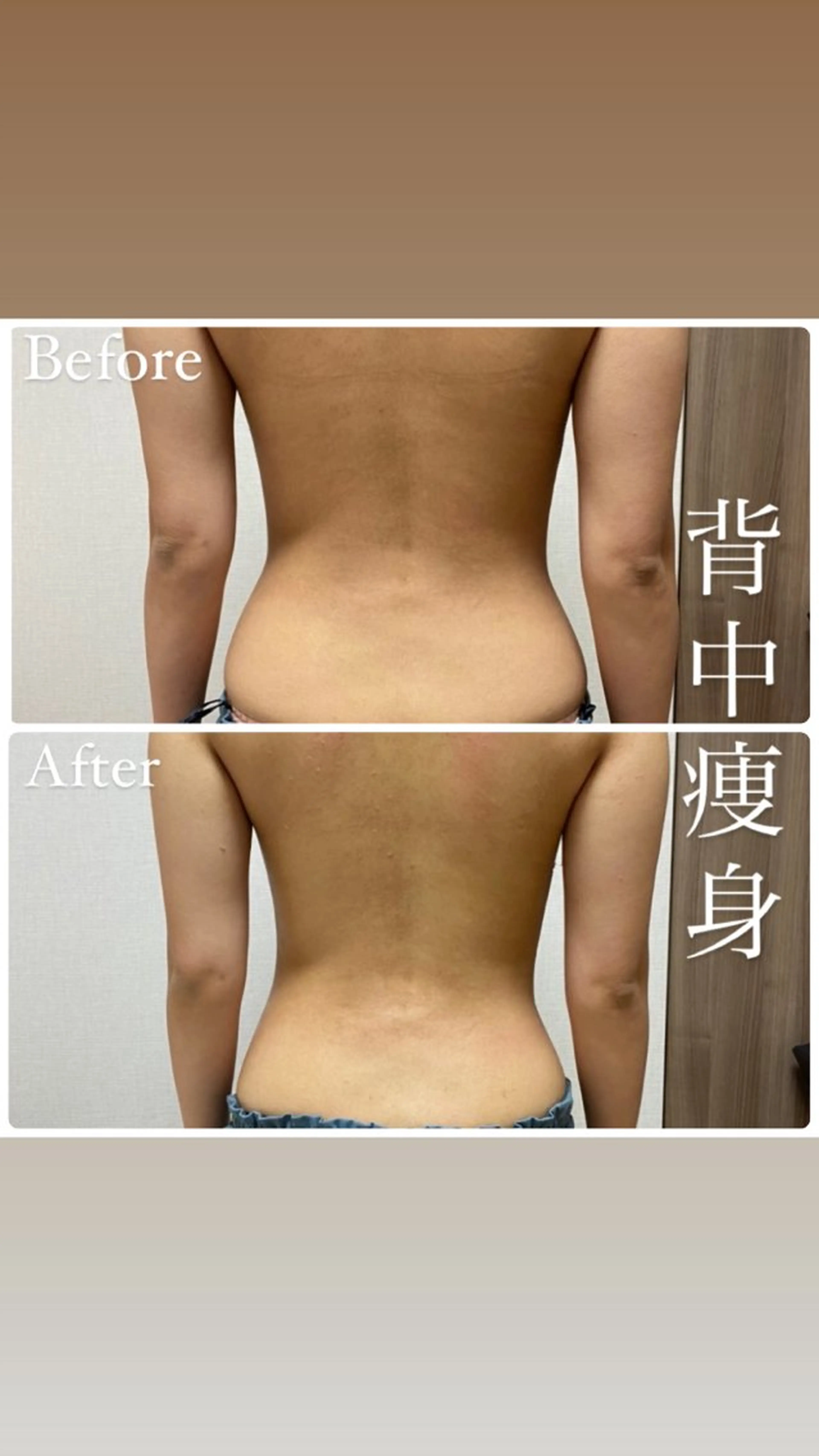 beautysalon RAVIS所属・東大阪/韓国肌管理/ 痩身バスト専門店のエステ・リラクイメージ