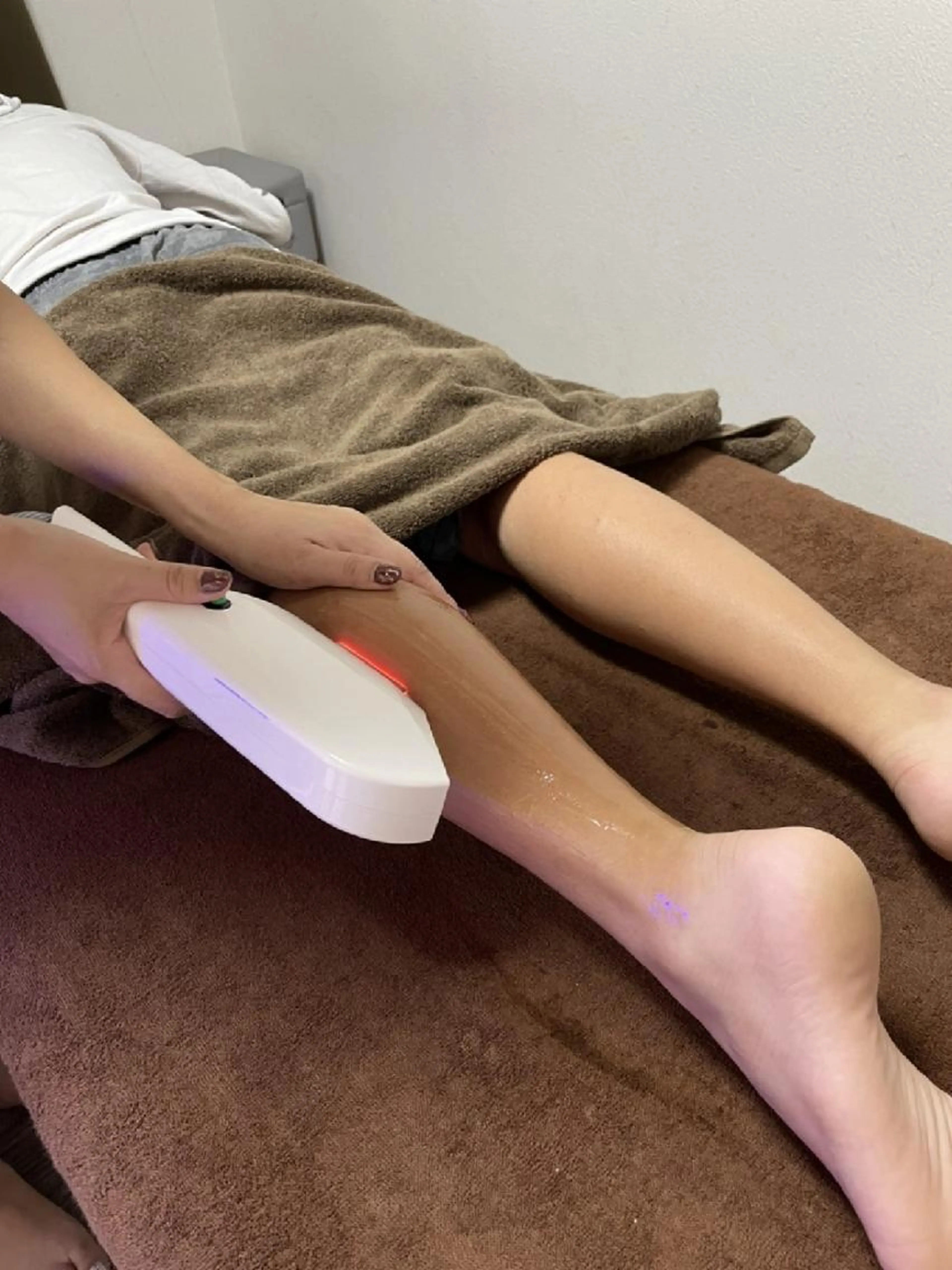 キッズ脱毛(上半身or下半身)の写真