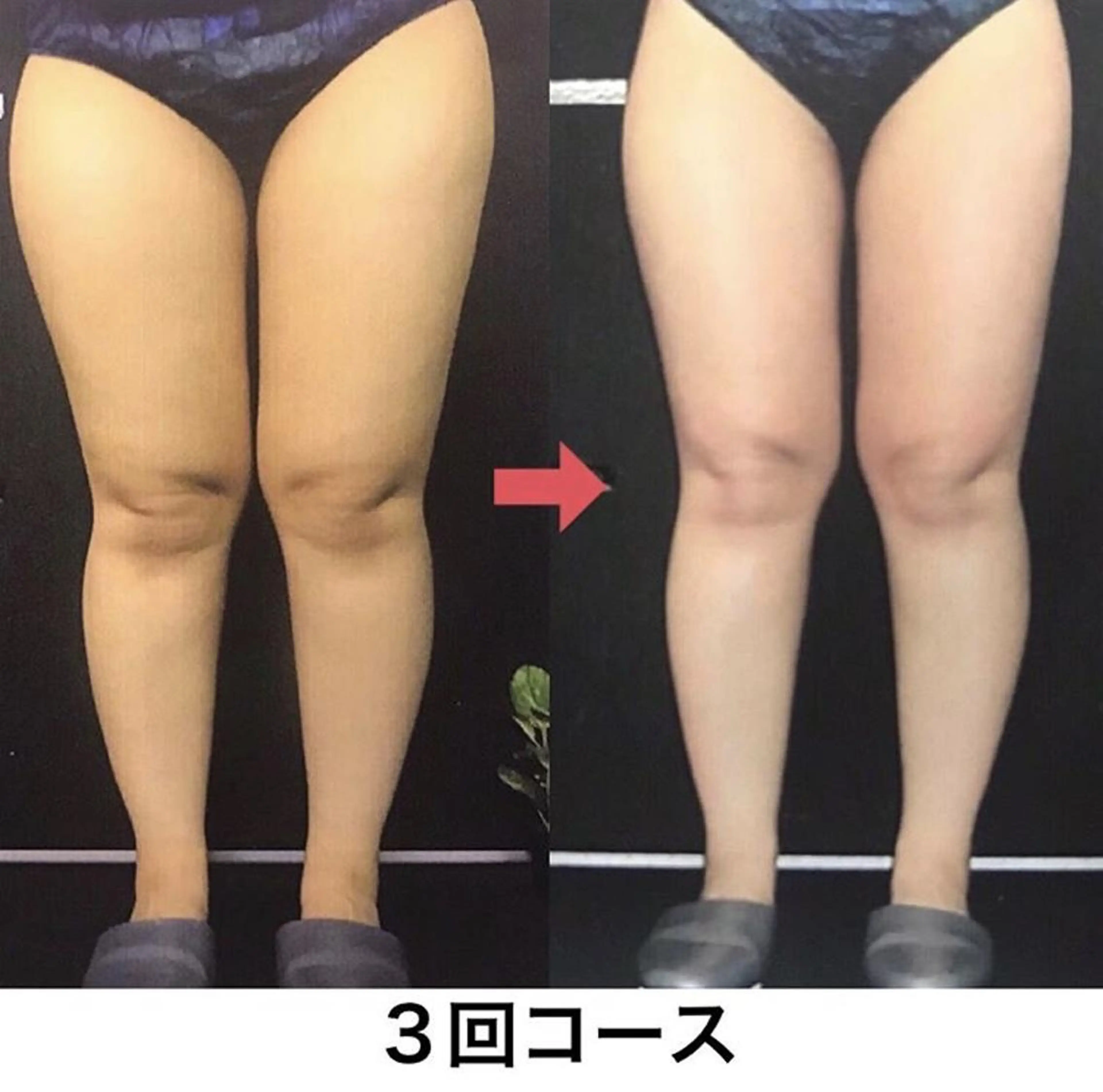 横浜エステサロン R-ing　リングのエステ・リラクイメージ