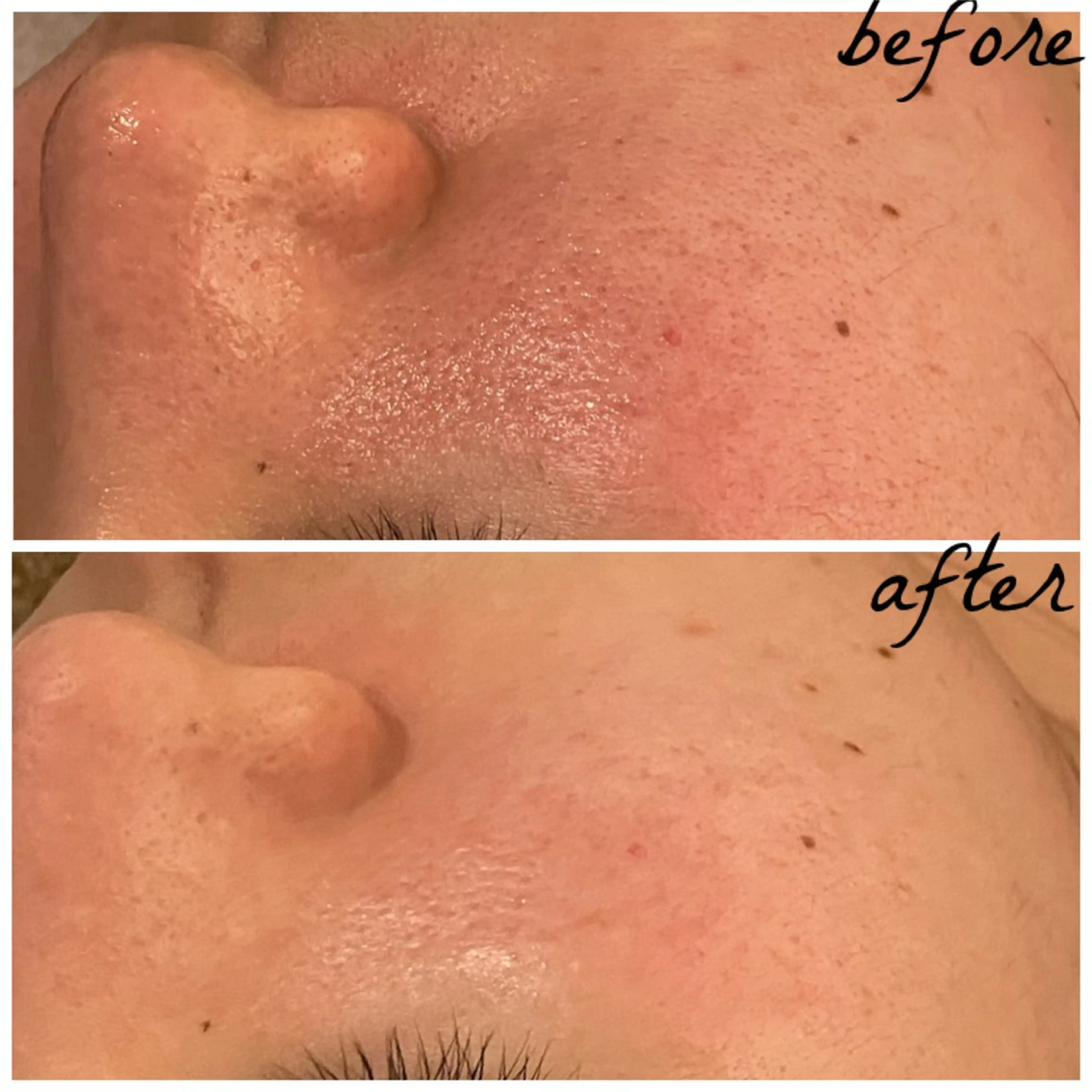 メンズ メナード岐阜茜部 杉浦のエステ・リラクイメージ