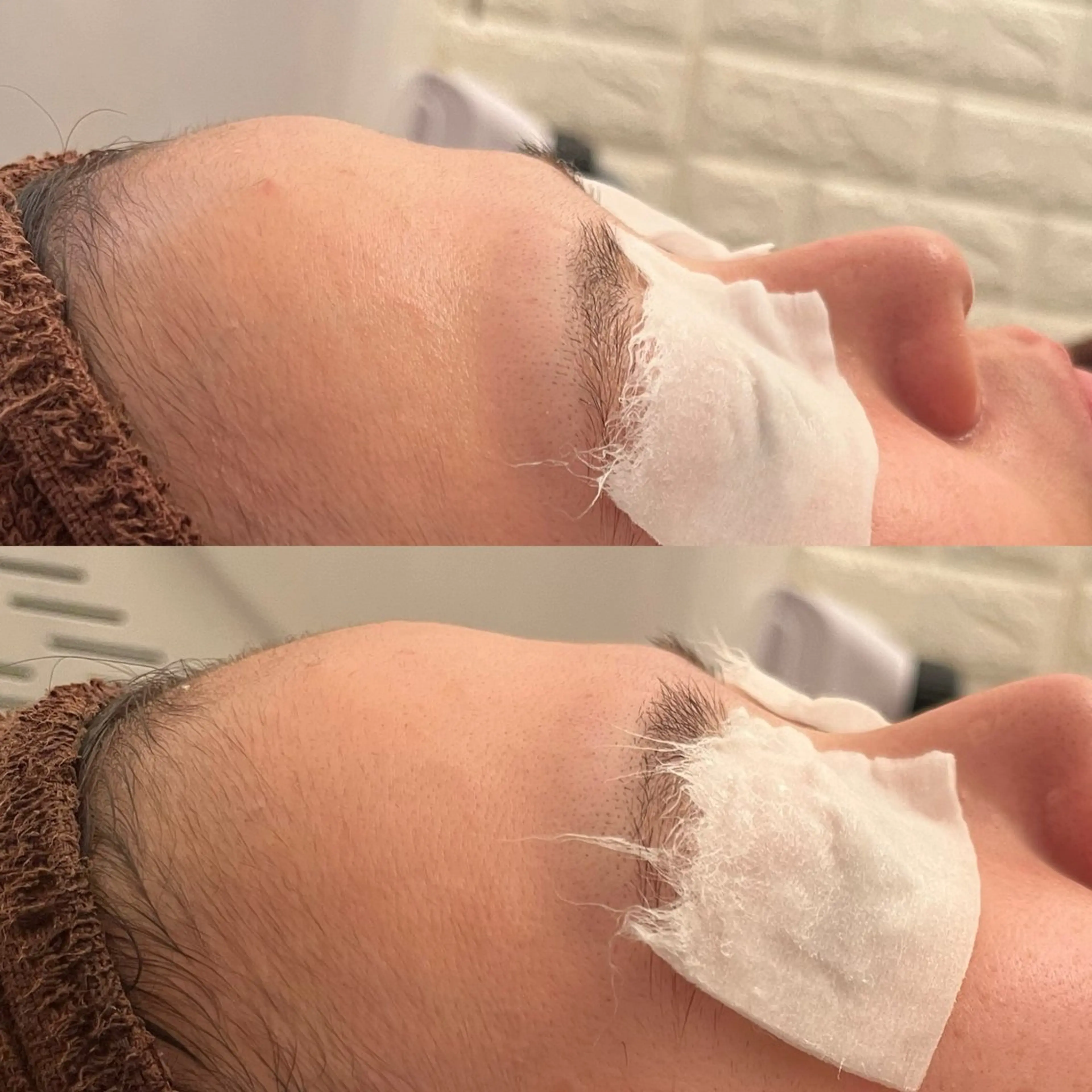 エステ リラク 毛穴ケア/毛穴診断/ 毛穴洗浄〔心斎橋〕のエステ・リラクイメージ