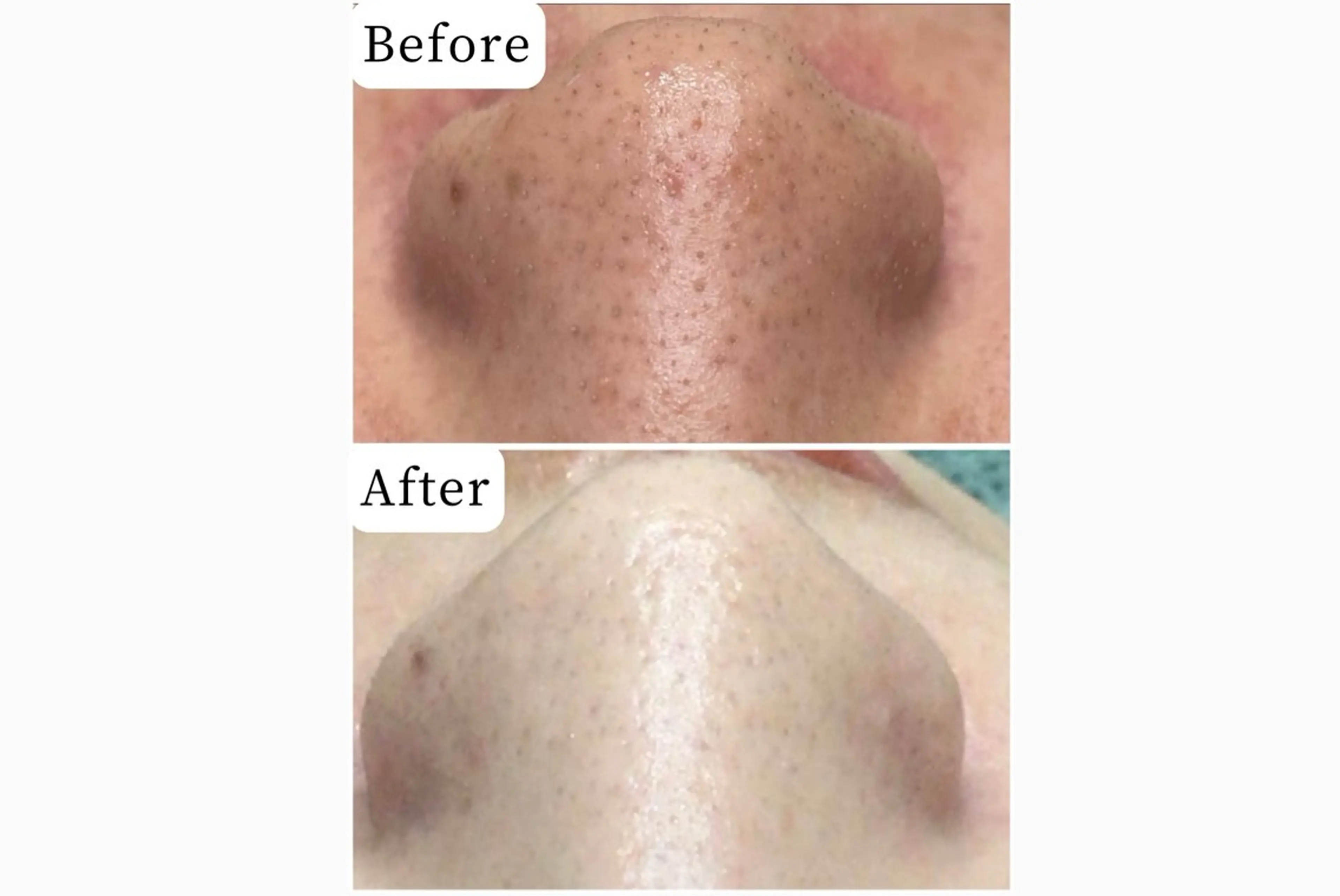 ハーブピーリング専門 muro.のエステ・リラクイメージ