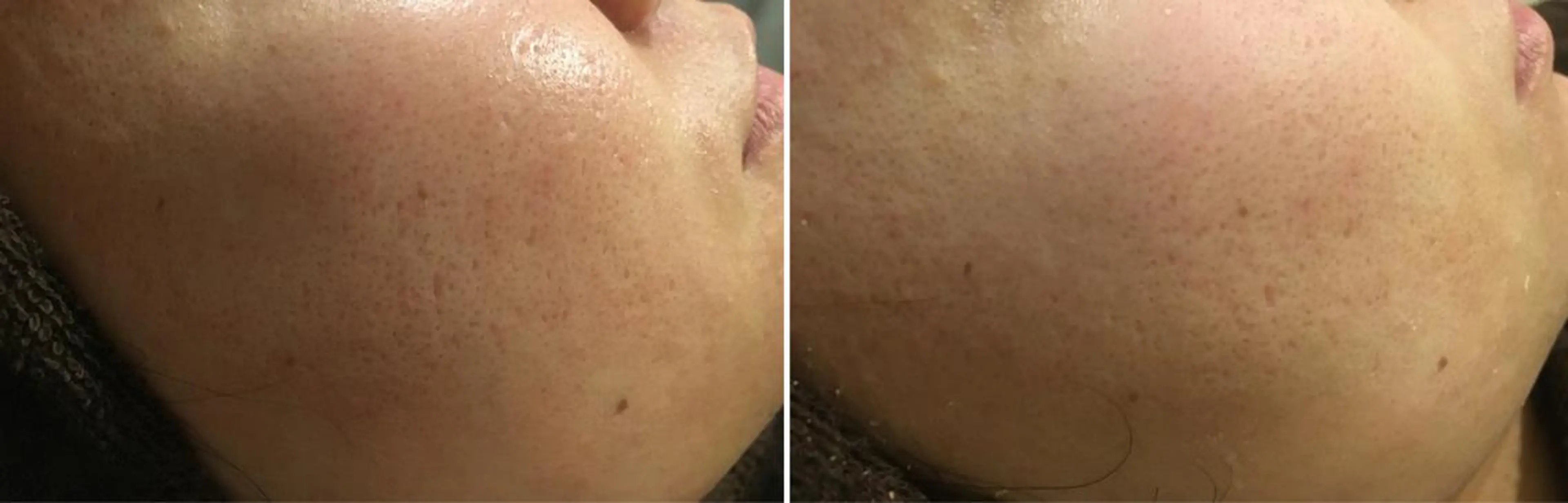 アニメ,Vオタク× 即効痩せエステサロンのエステ・リラクイメージ