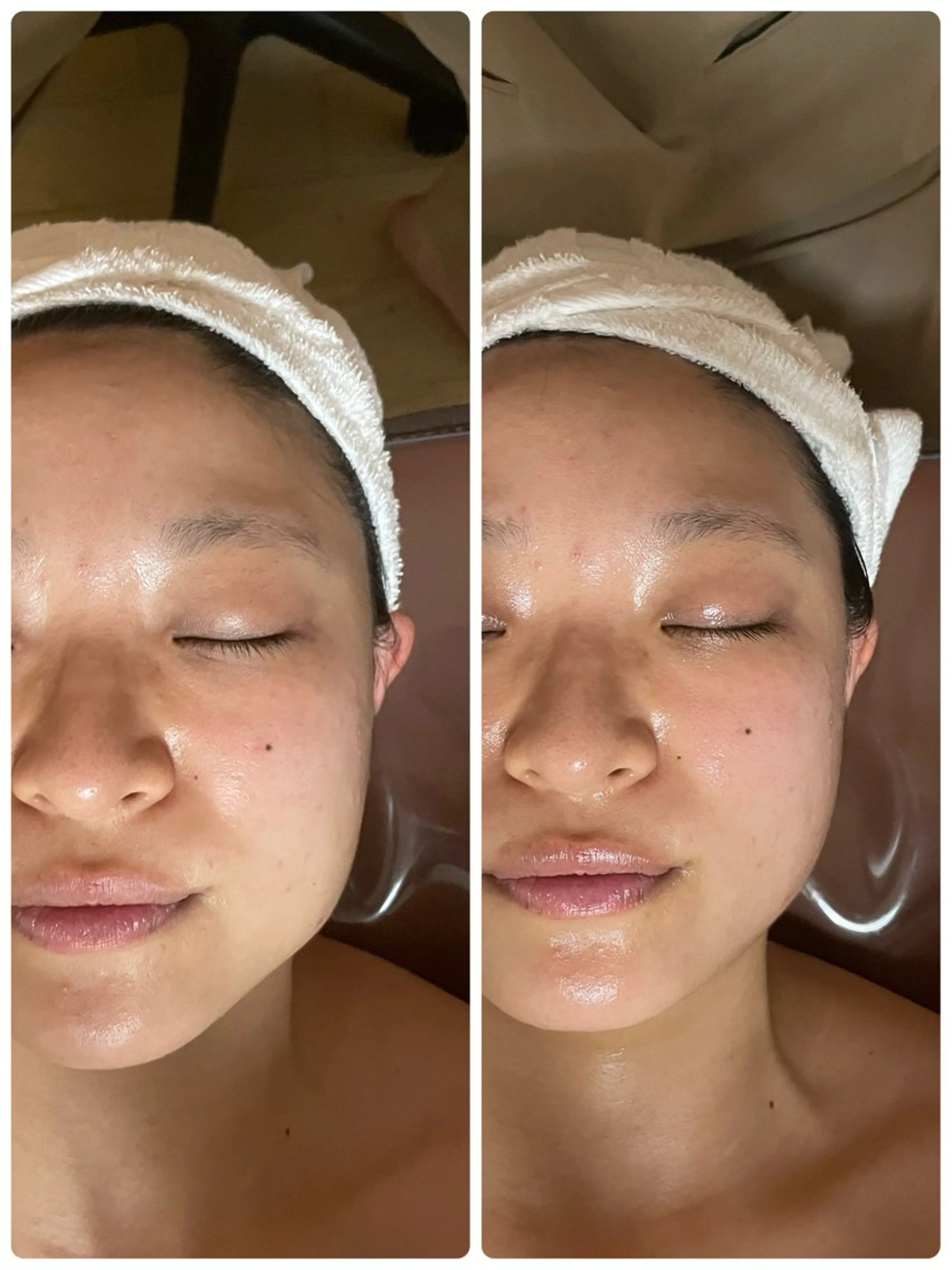 【初回限定】小顔矯正50分　むくみ、たるみ、エラハリさんに！　クレンジング・小顔トリートメント・お肌別パック・お仕上げの写真