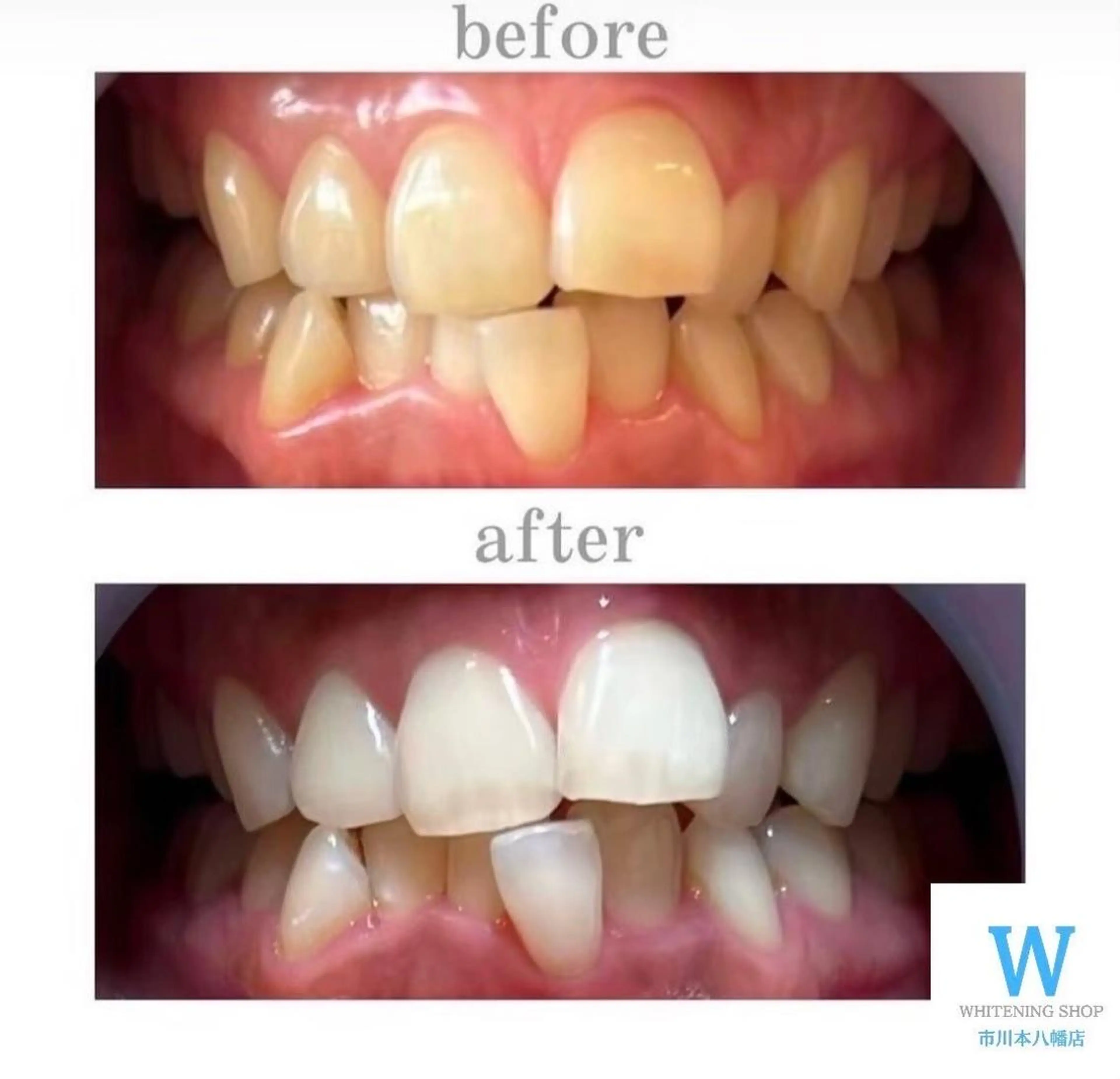 ホワイトニング ショップ本八幡店のエステ・リラクイメージ