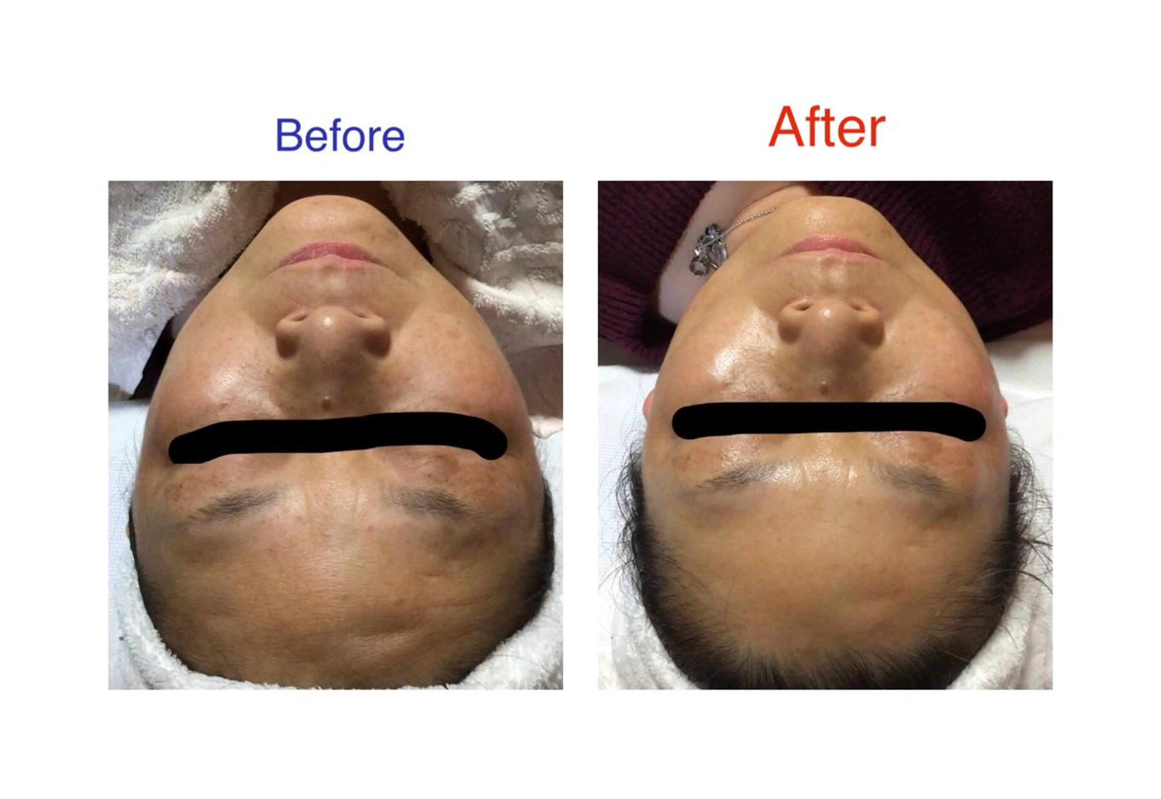 子宮矯正/腸揉み/ シュガーリング脱毛のエステ・リラクイメージ