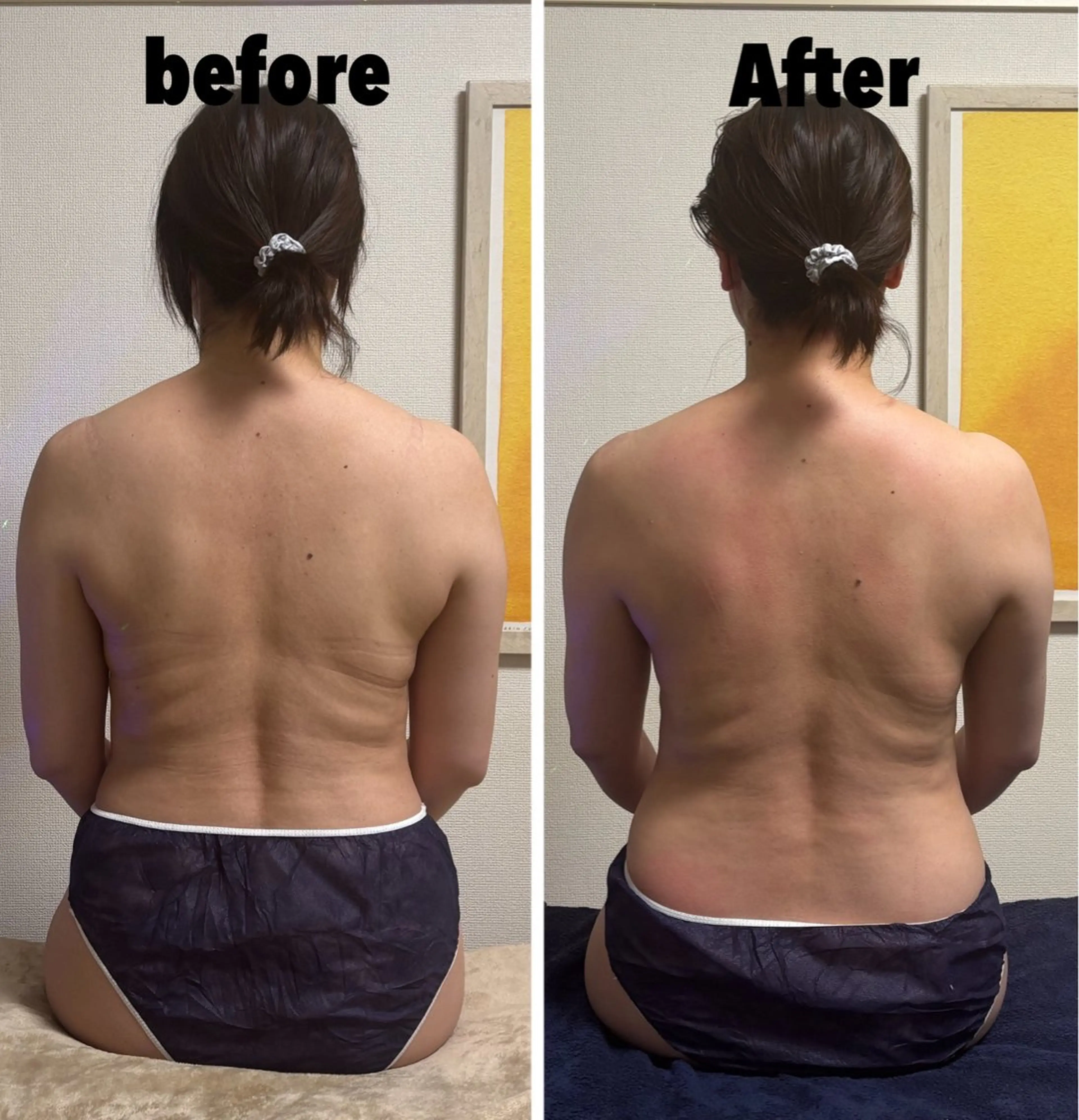 【全身疲労や緊急ダイエットに🆘】ロミロミ痩身120分🌺の写真