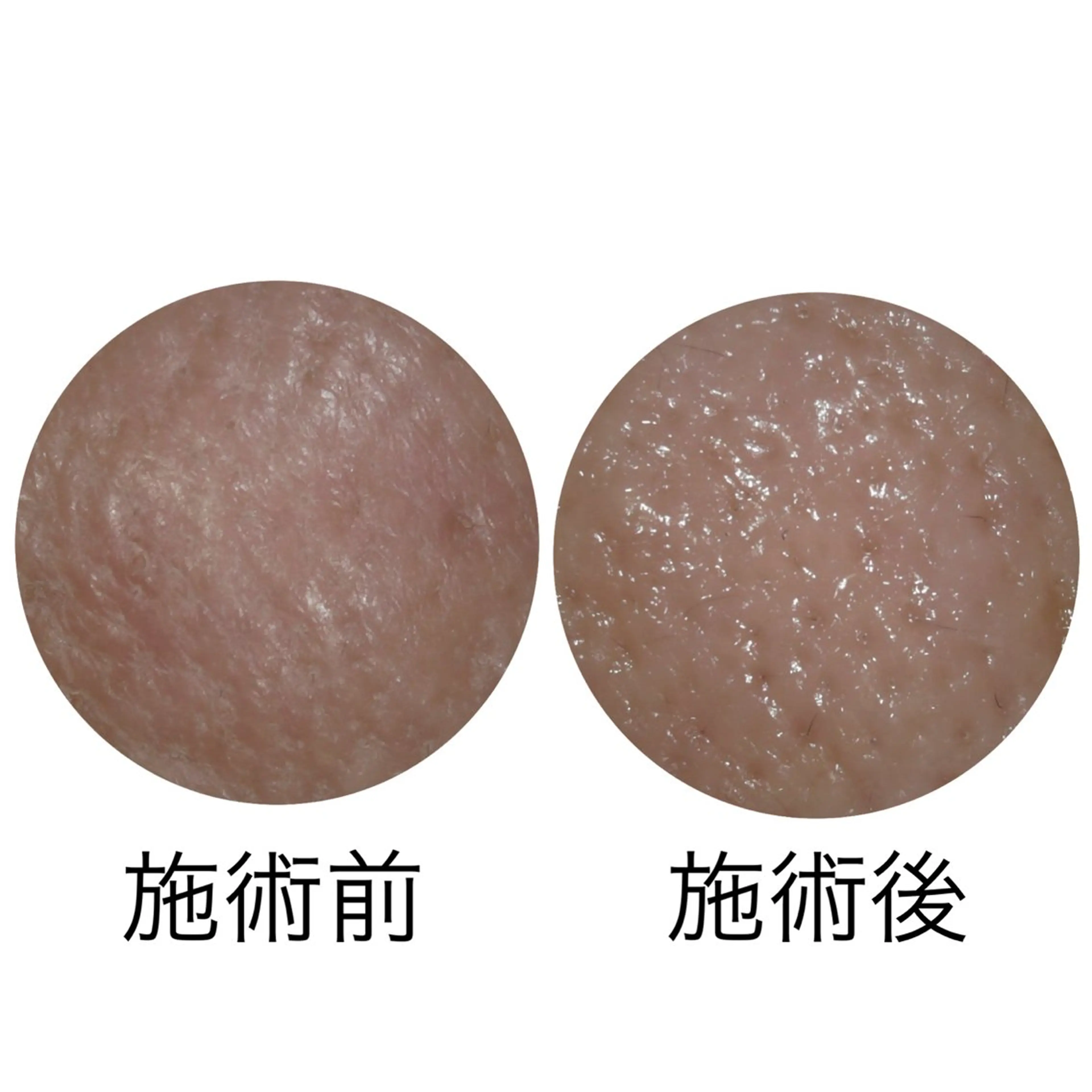 メナードフェイシャルサロン丸の内ヒルズ所属・メナード丸の内ヒルズ 柳田りさのエステ・リラクイメージ