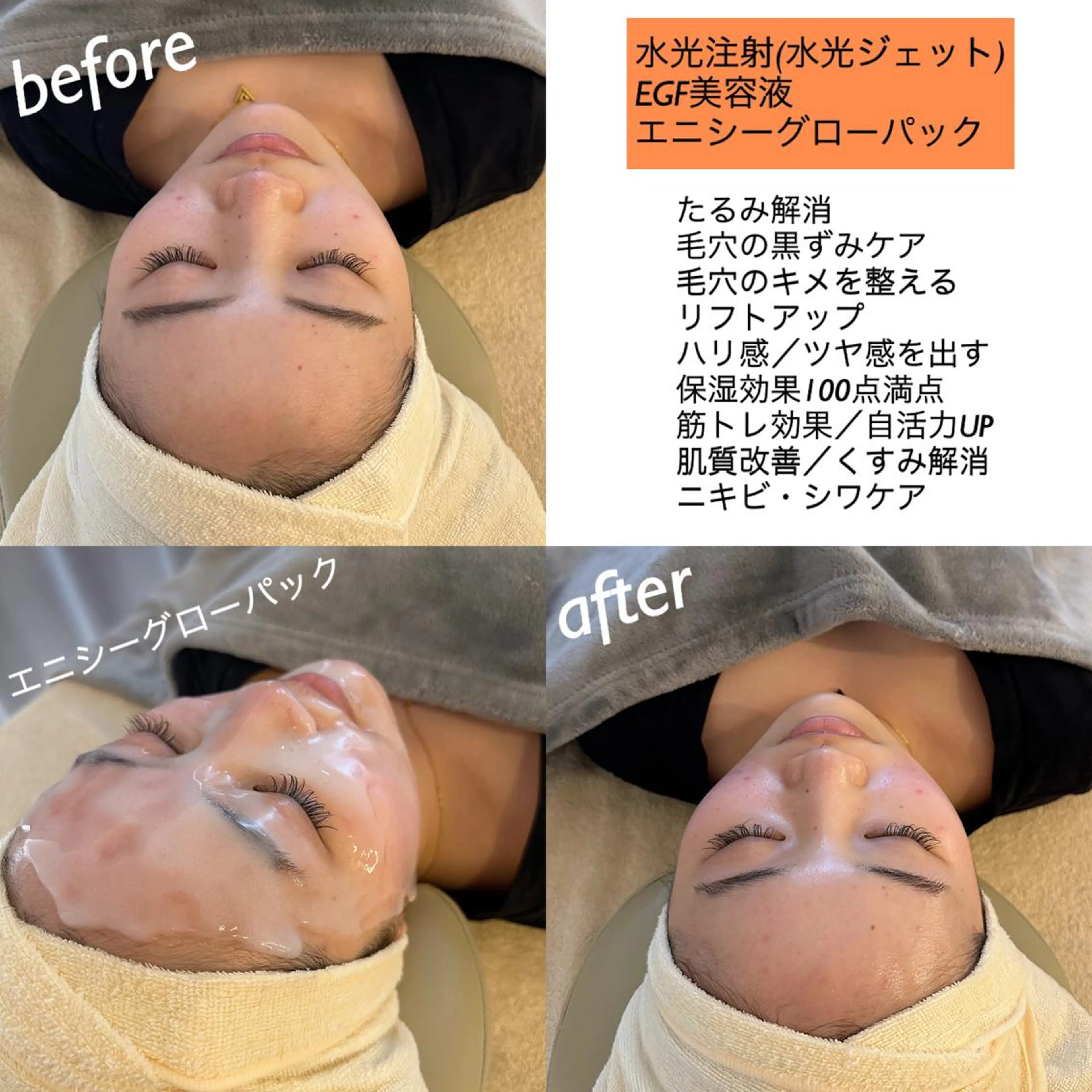 うなじ脱毛/美肌脱毛 LABELのエステ・リラクイメージ