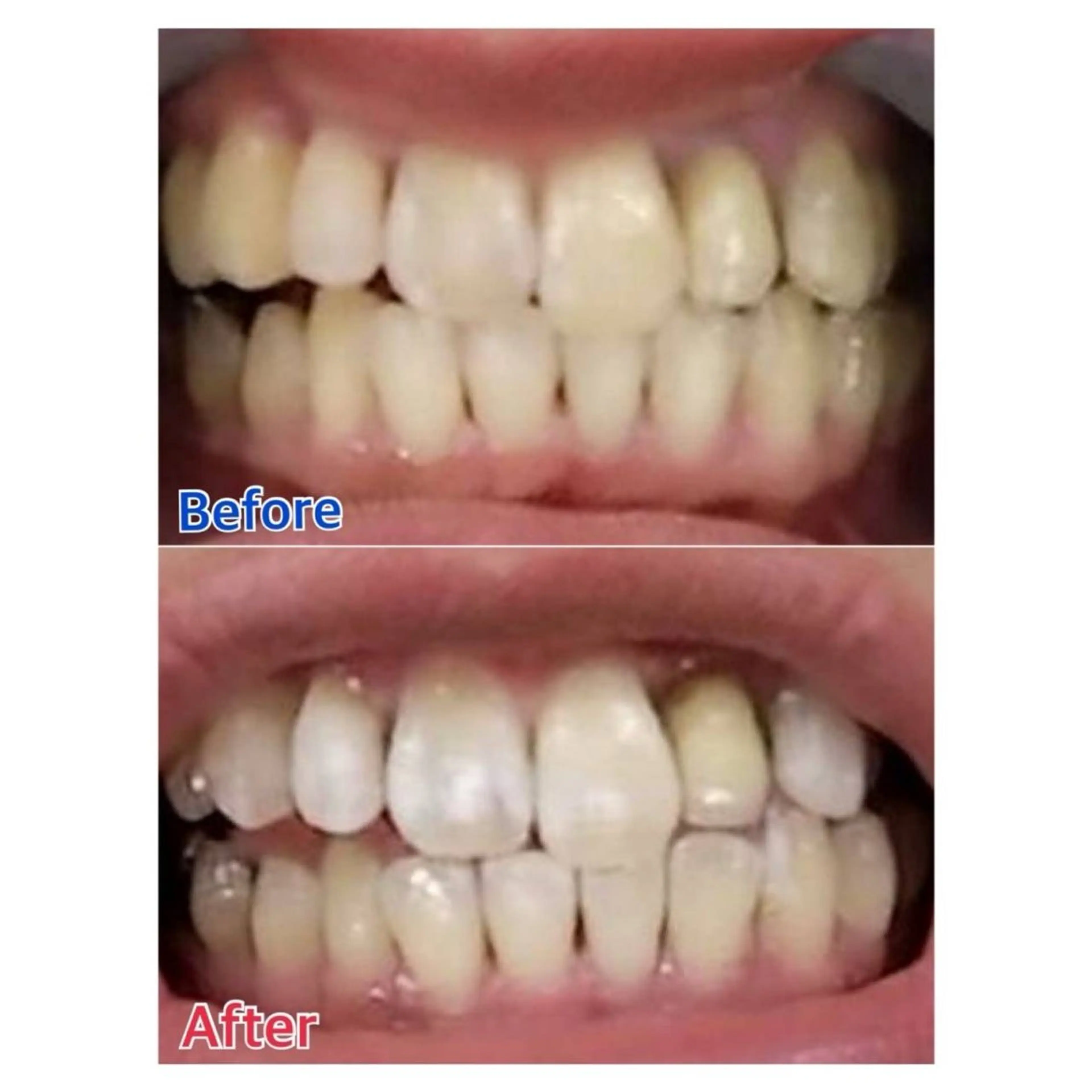 MBEAUTYSALON 千葉店・京成大久保所属・Melty 輝のその他イメージ