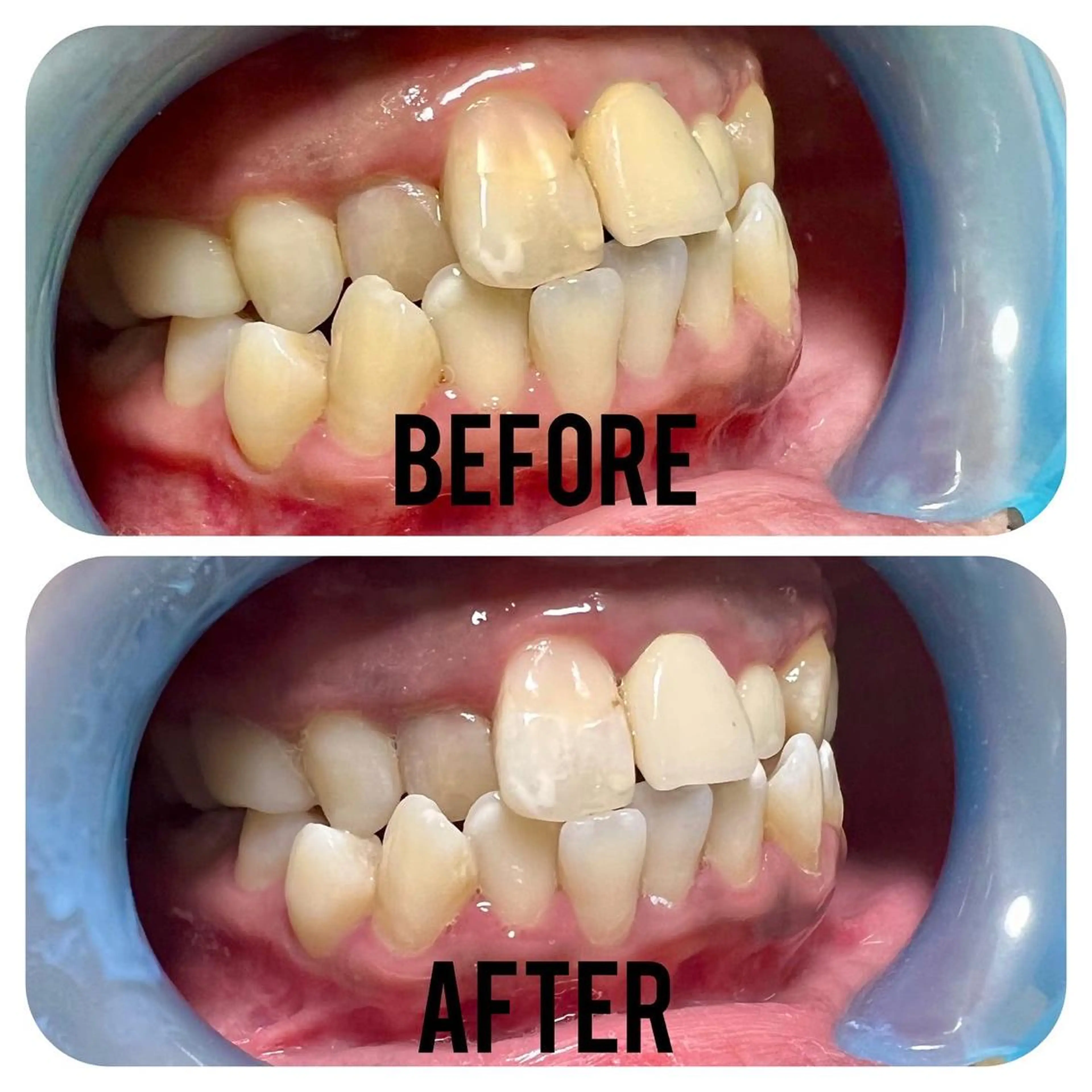 その他 two nailのネイルデザイン