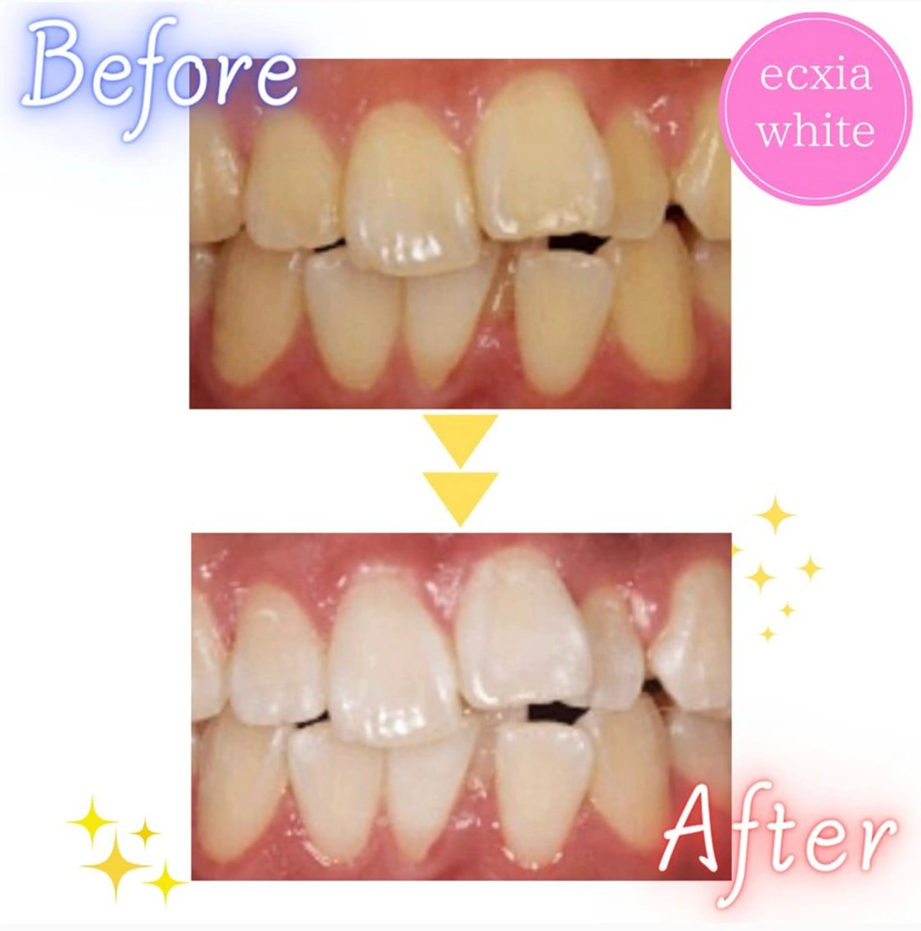 メンズ その他 エクシアホワイトニング草津店所属・nanami -ホワイトニングのその他イメージ