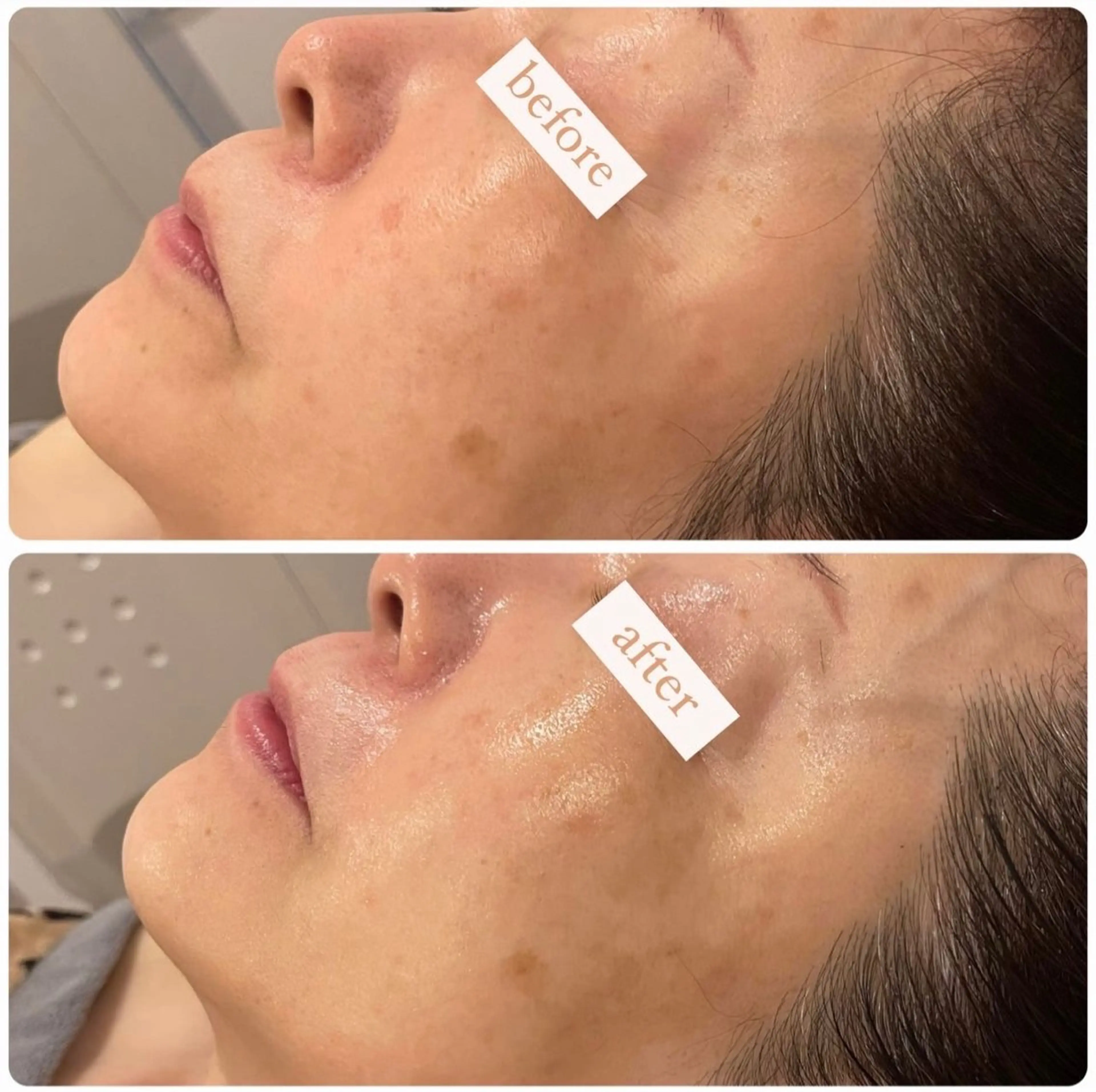 立体小顔×艶肌×美ボ ディ似合わせ施術 岡のエステ・リラクイメージ