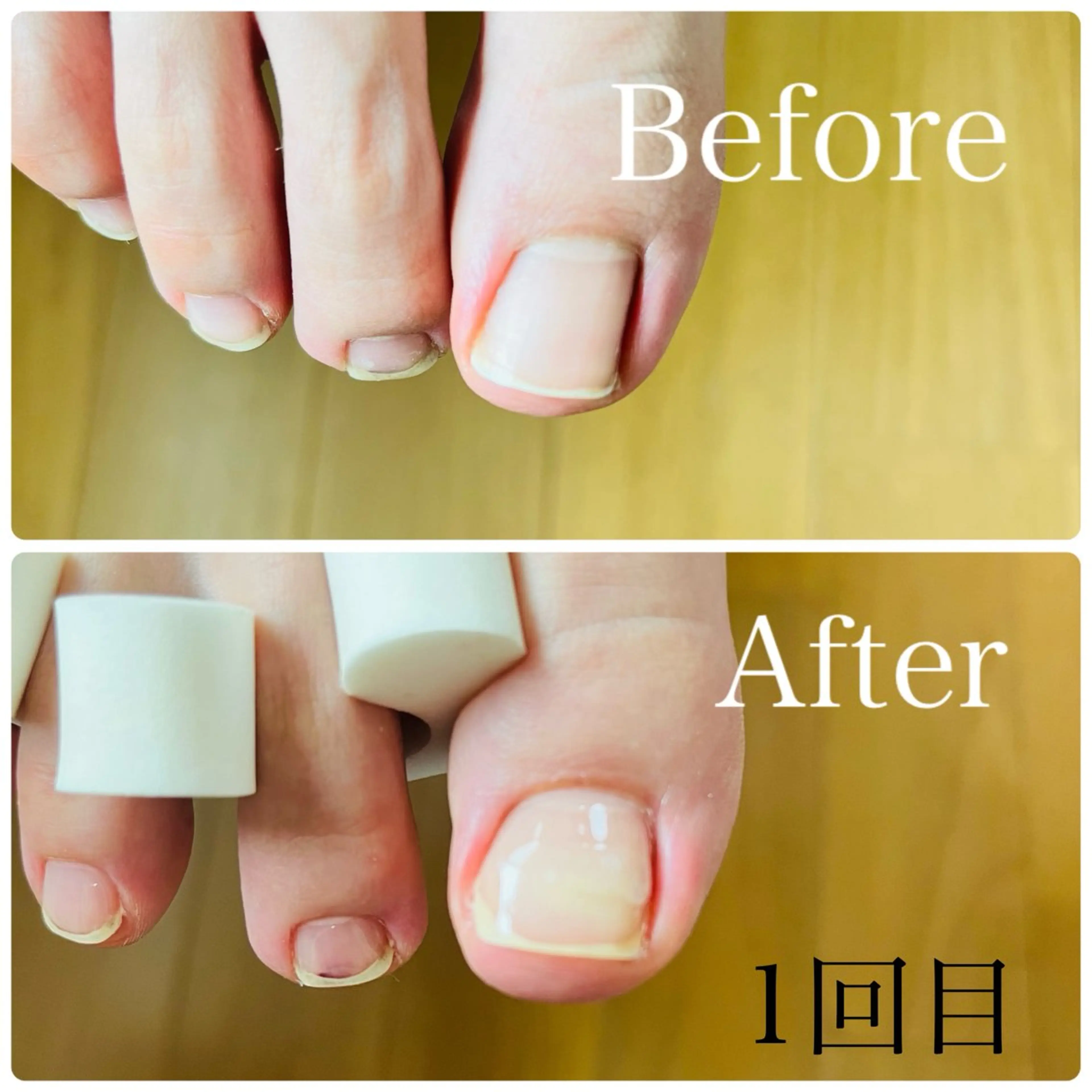 ネイル Briwa✨nail 💅enoi ❤︎のネイルデザイン