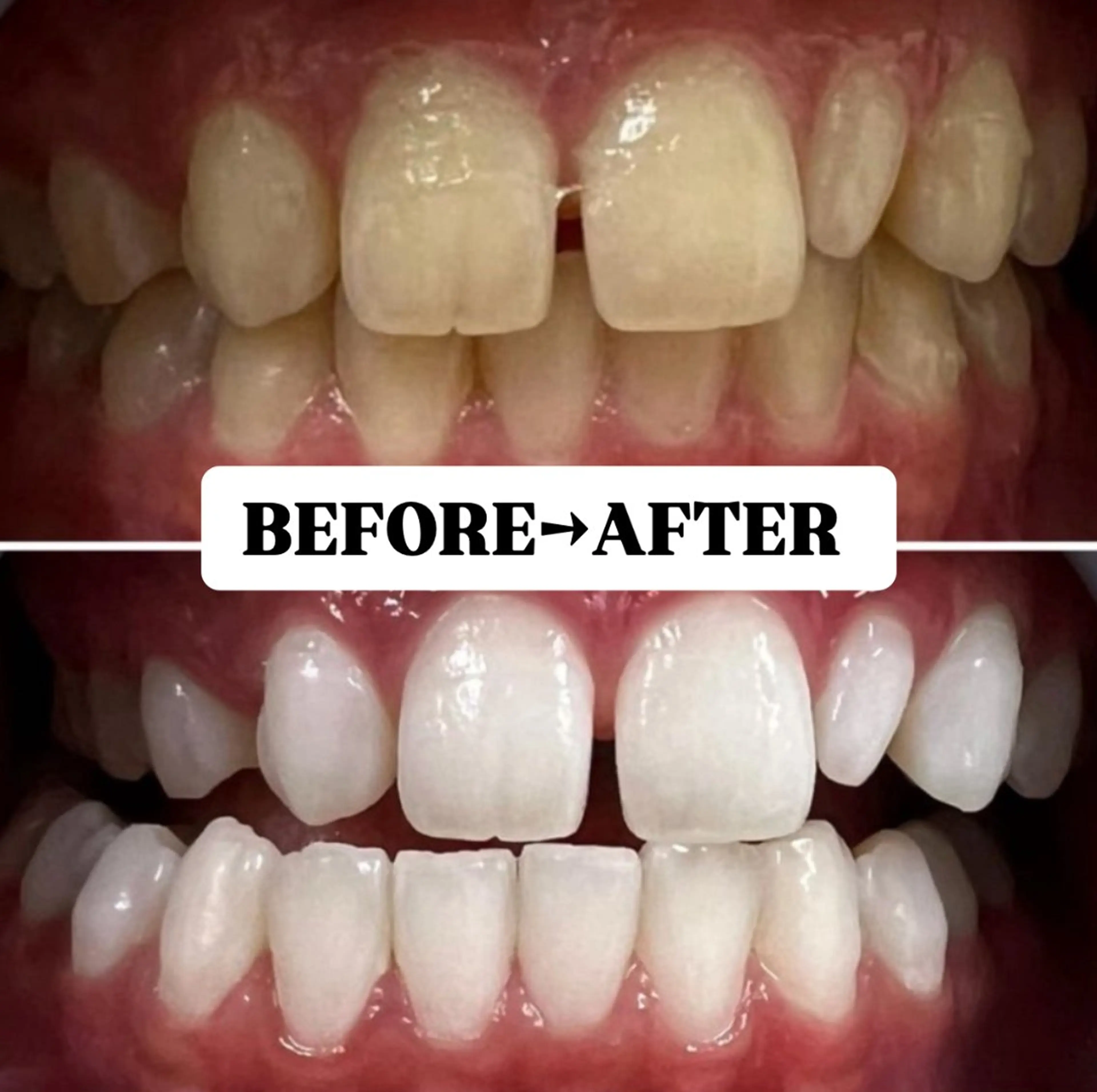 メンズ キッズ 歯科提携サロン ホワイトニング豊中のその他イメージ