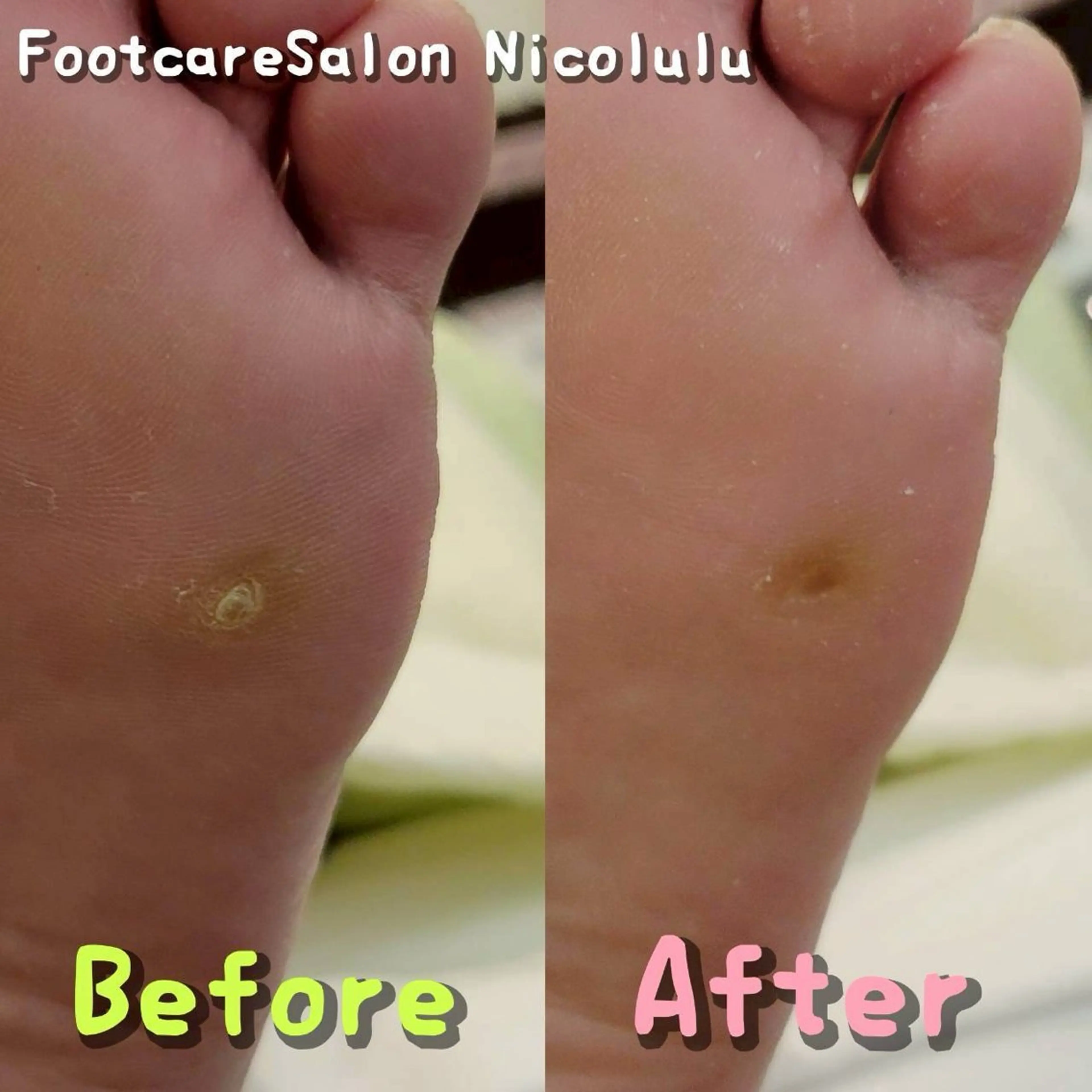 リラク 足トラブル専門 ニコルル金沢のエステ・リラクイメージ