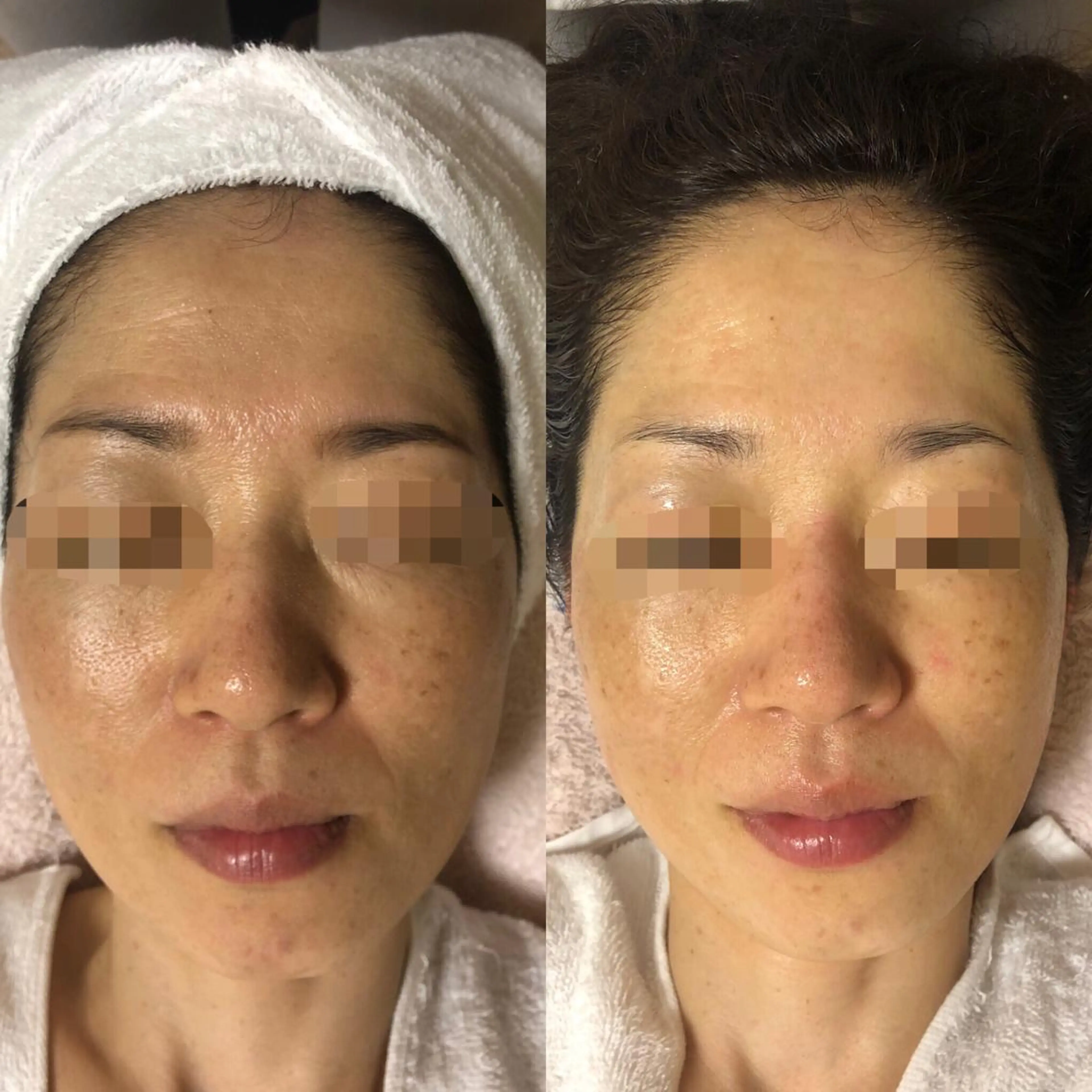 エステ エスカル ボーテのエステ・リラクイメージ