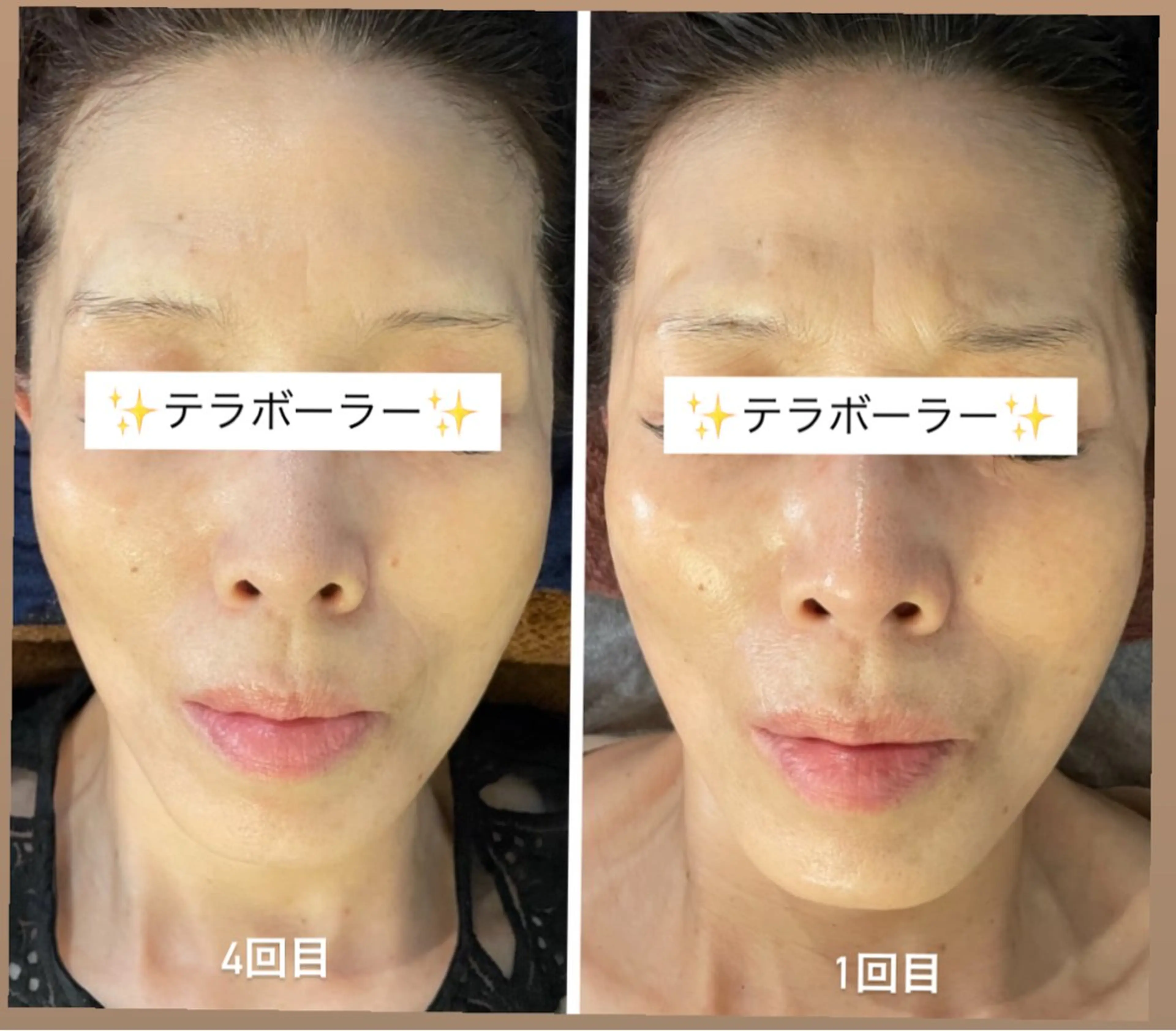 耳ツボ/体質改善/ 温活La mer月島のその他イメージ