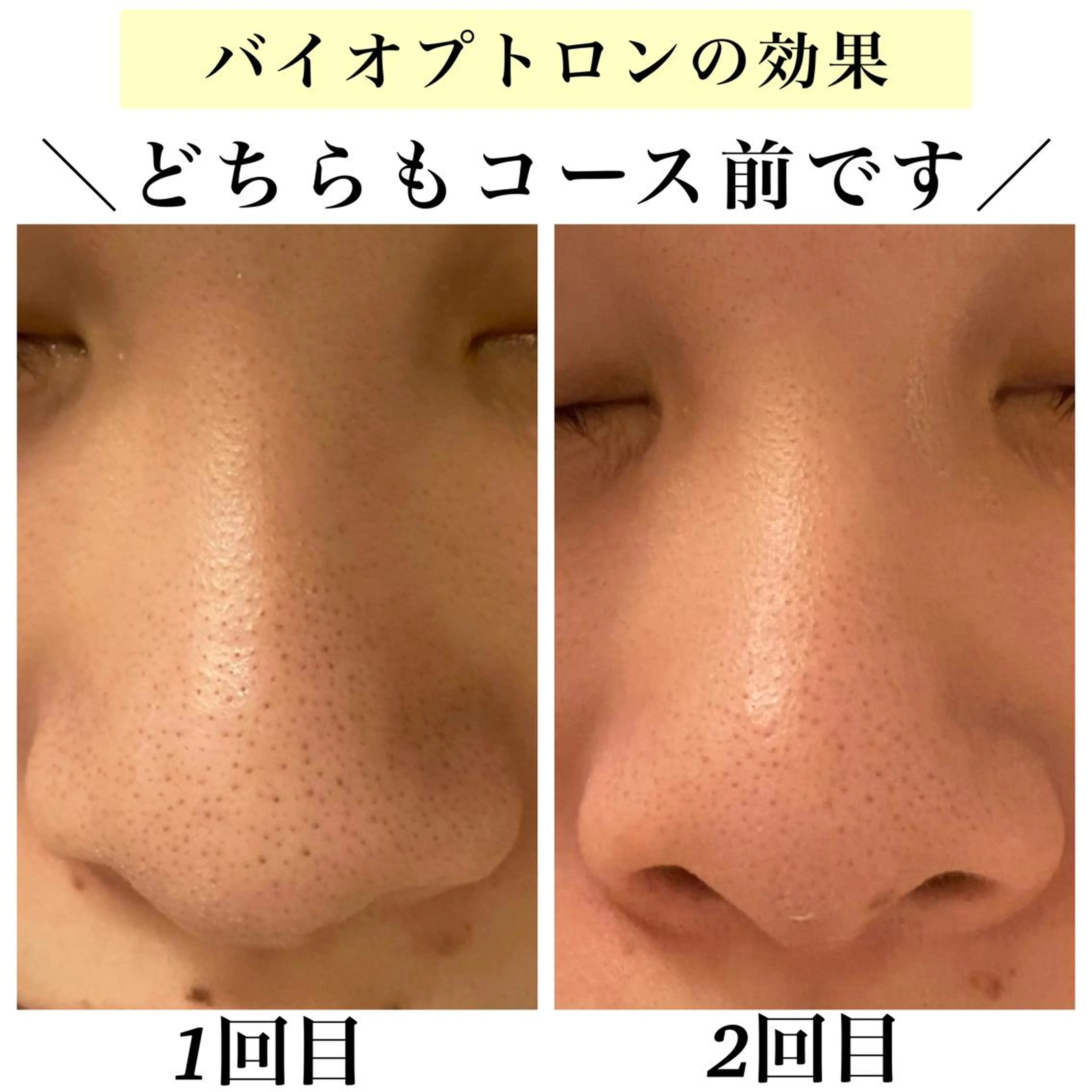 エステ リラク Bellesthe (ベルエステ)のエステ・リラクイメージ